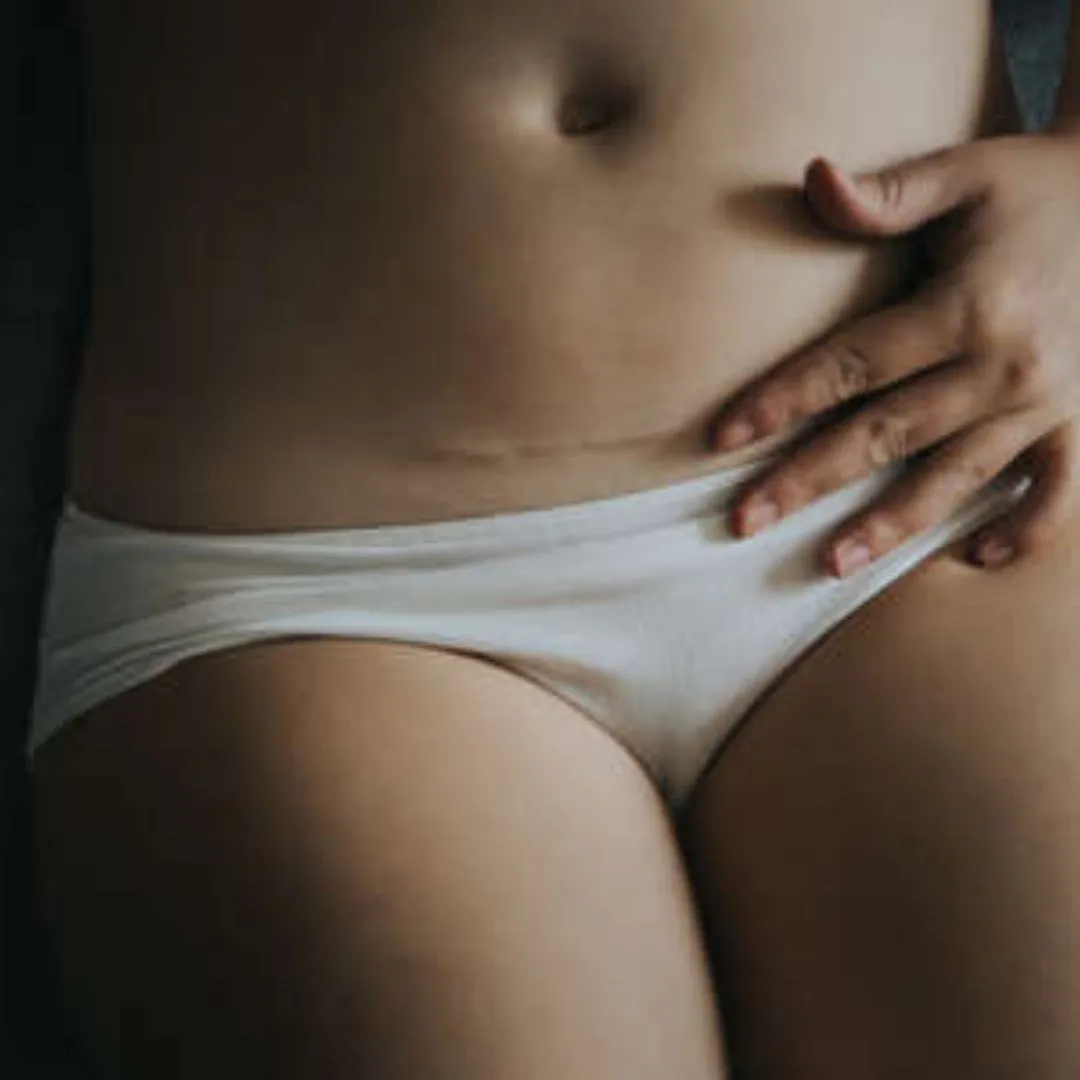 Quels sont les avantages supposés de la césarienne extrapéritonéale ?