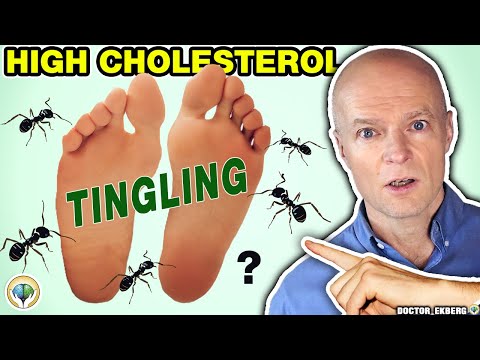 10 Common Signs of High CHOLESTEROL You MUST NOT Ignore
