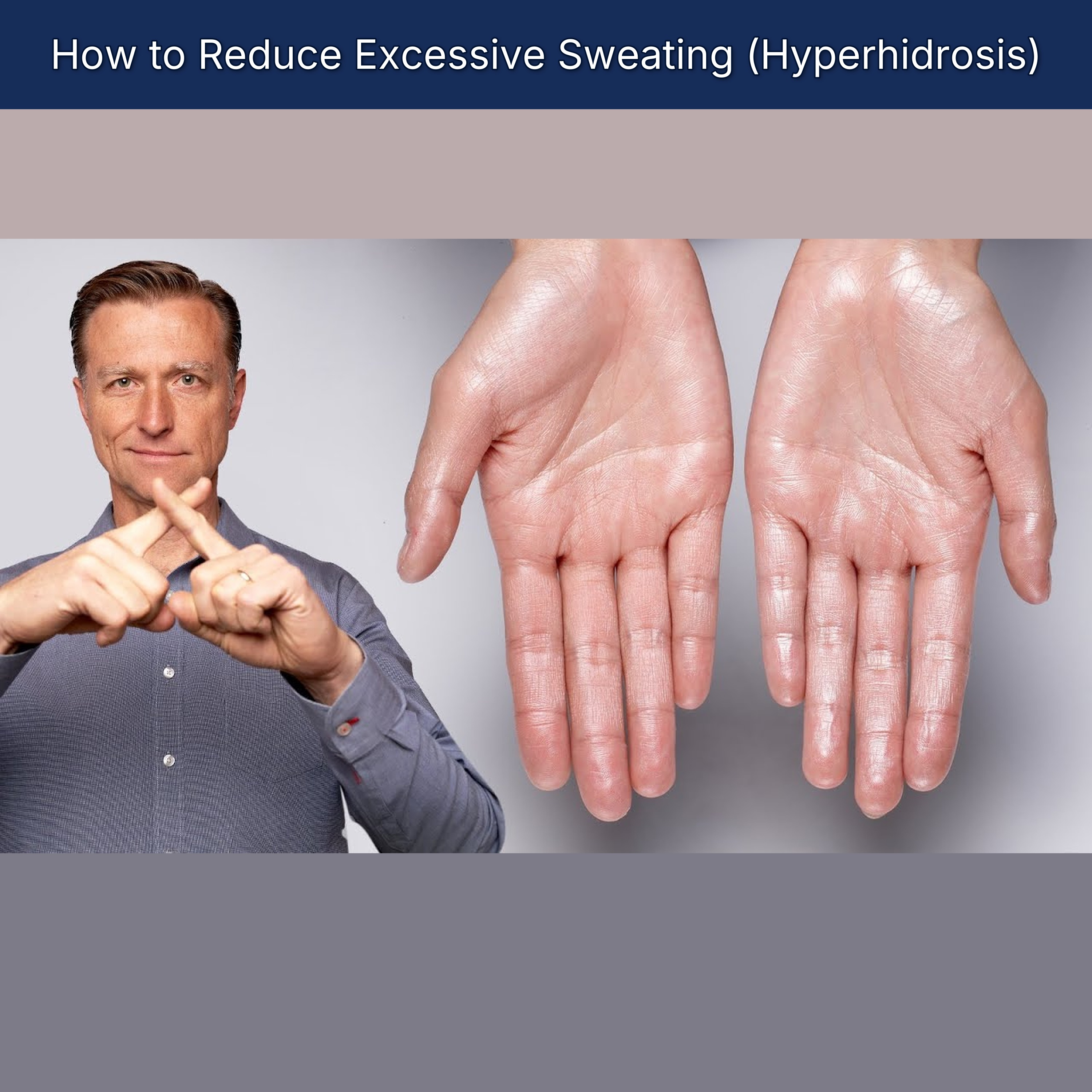 How to Reduce Excessive Sweating (Hyperhidrosis)
