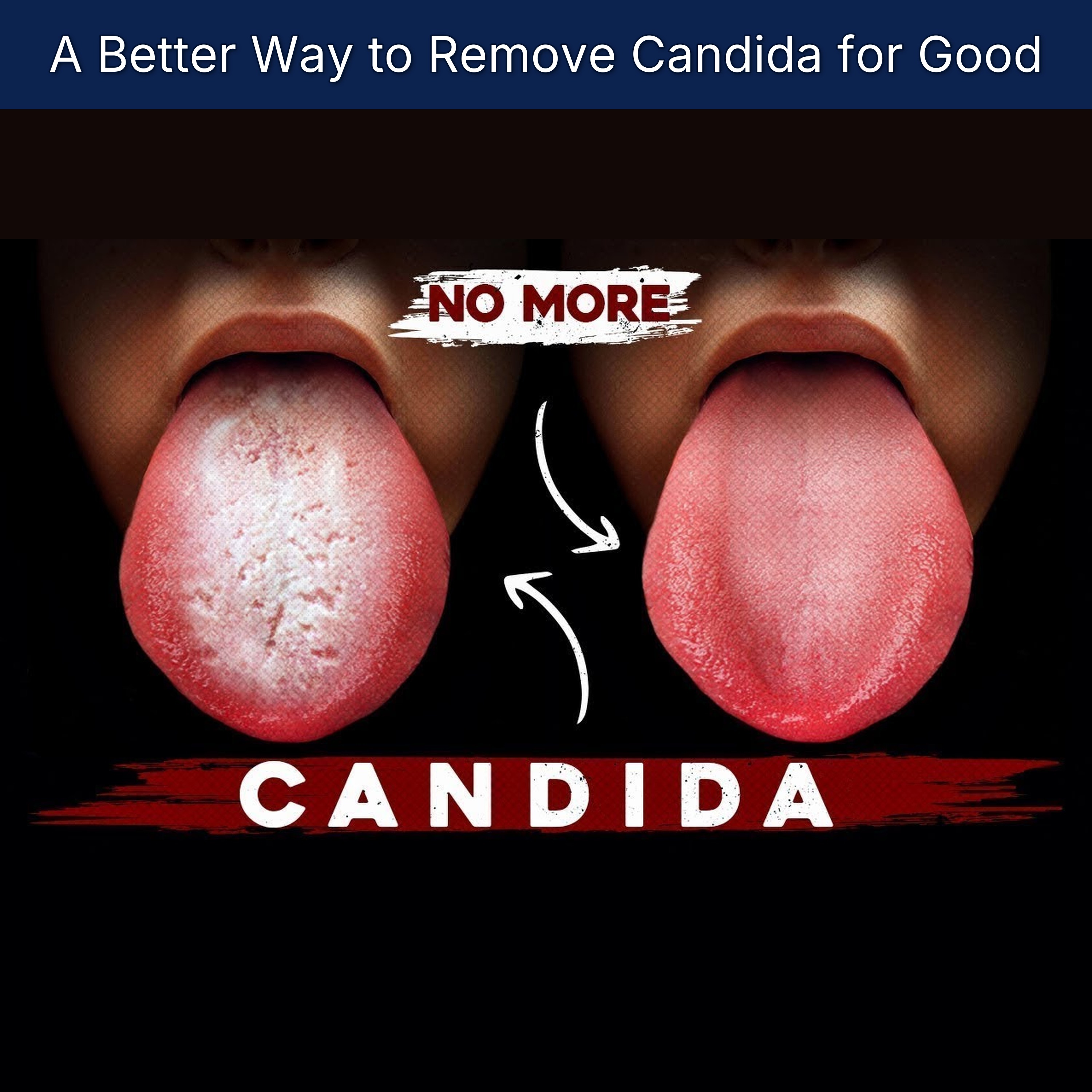 A Better Way to Remove Candida for Good episode artwork