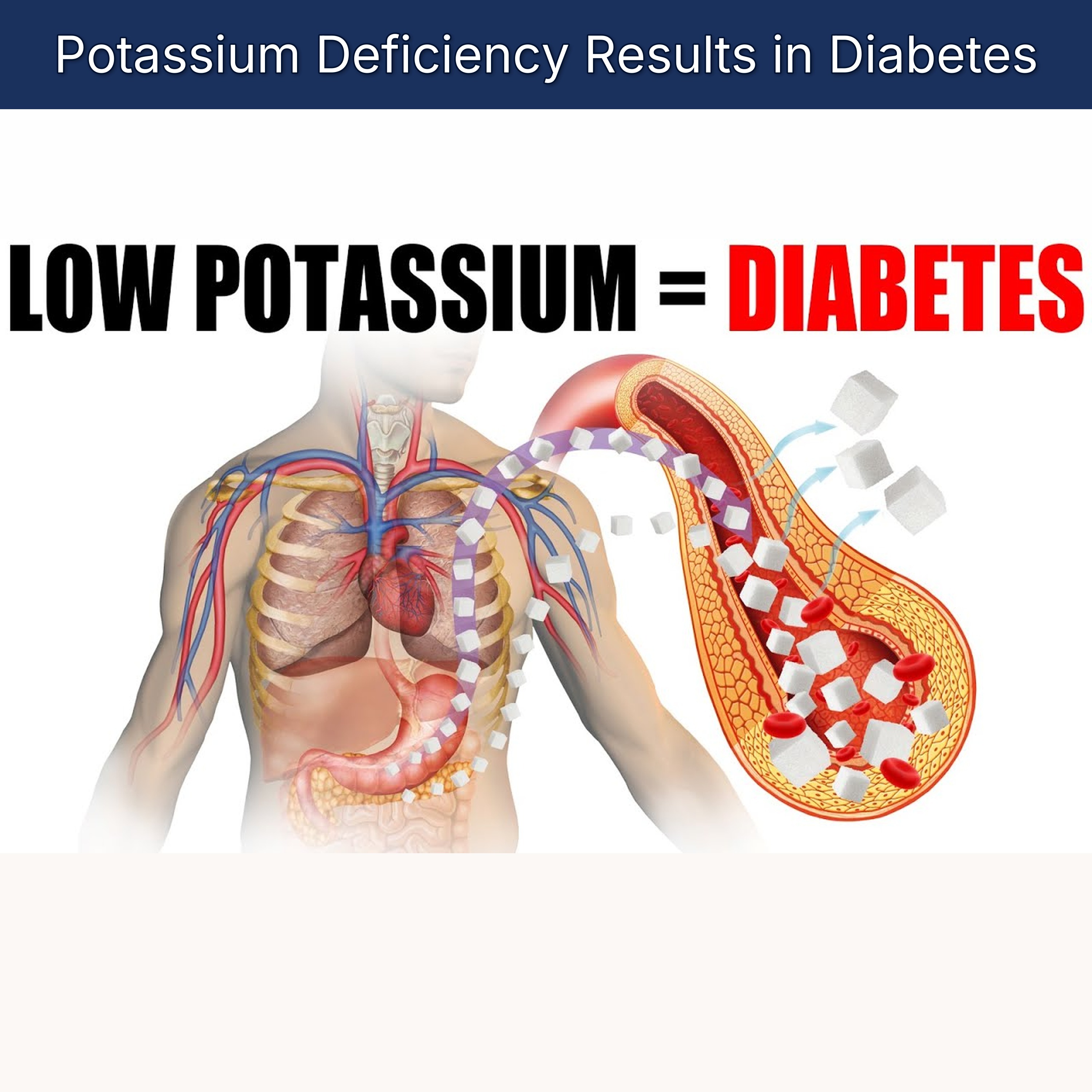 Potassium Deficiency Results in Diabetes