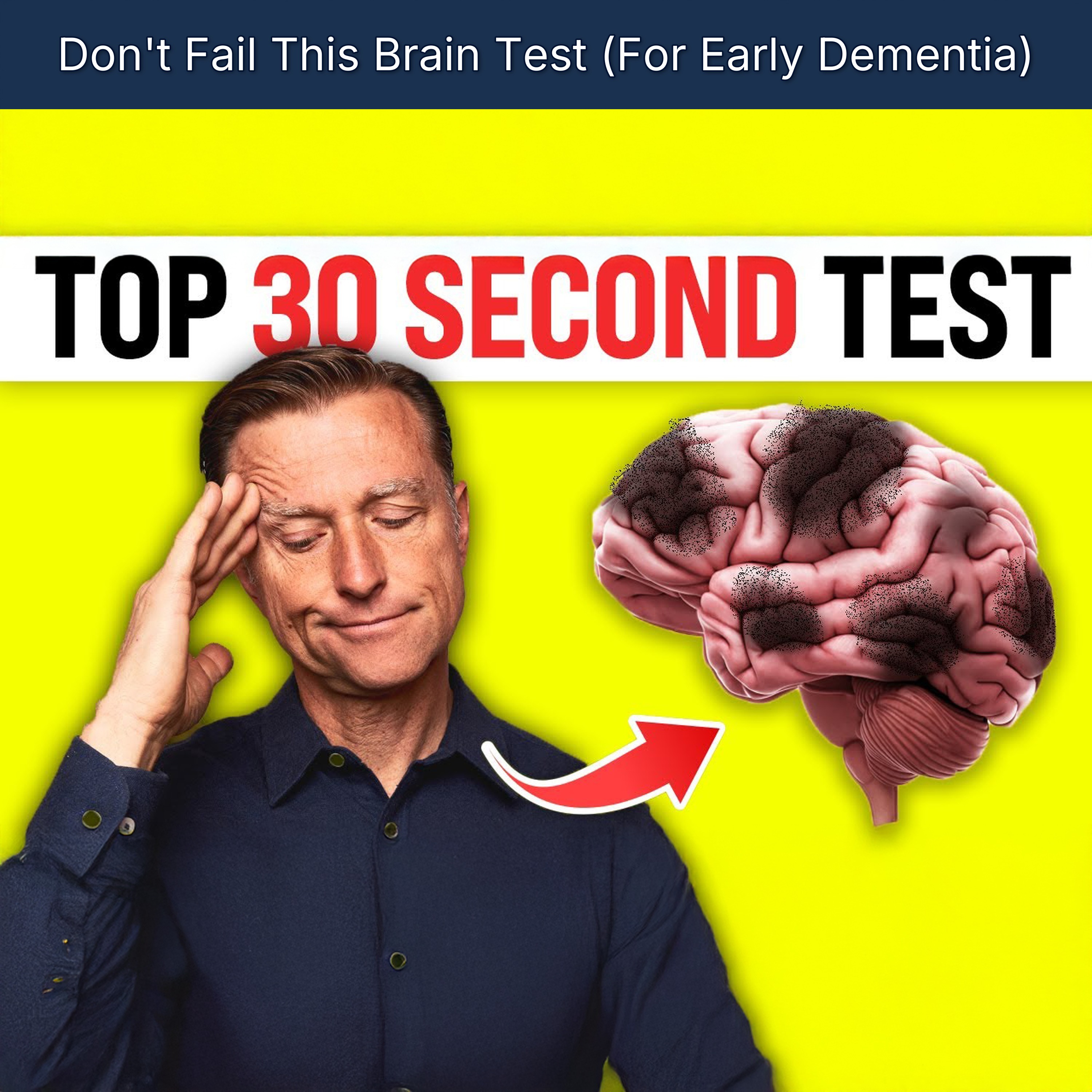 Don't Fail This Brain Test (For Early Dementia)