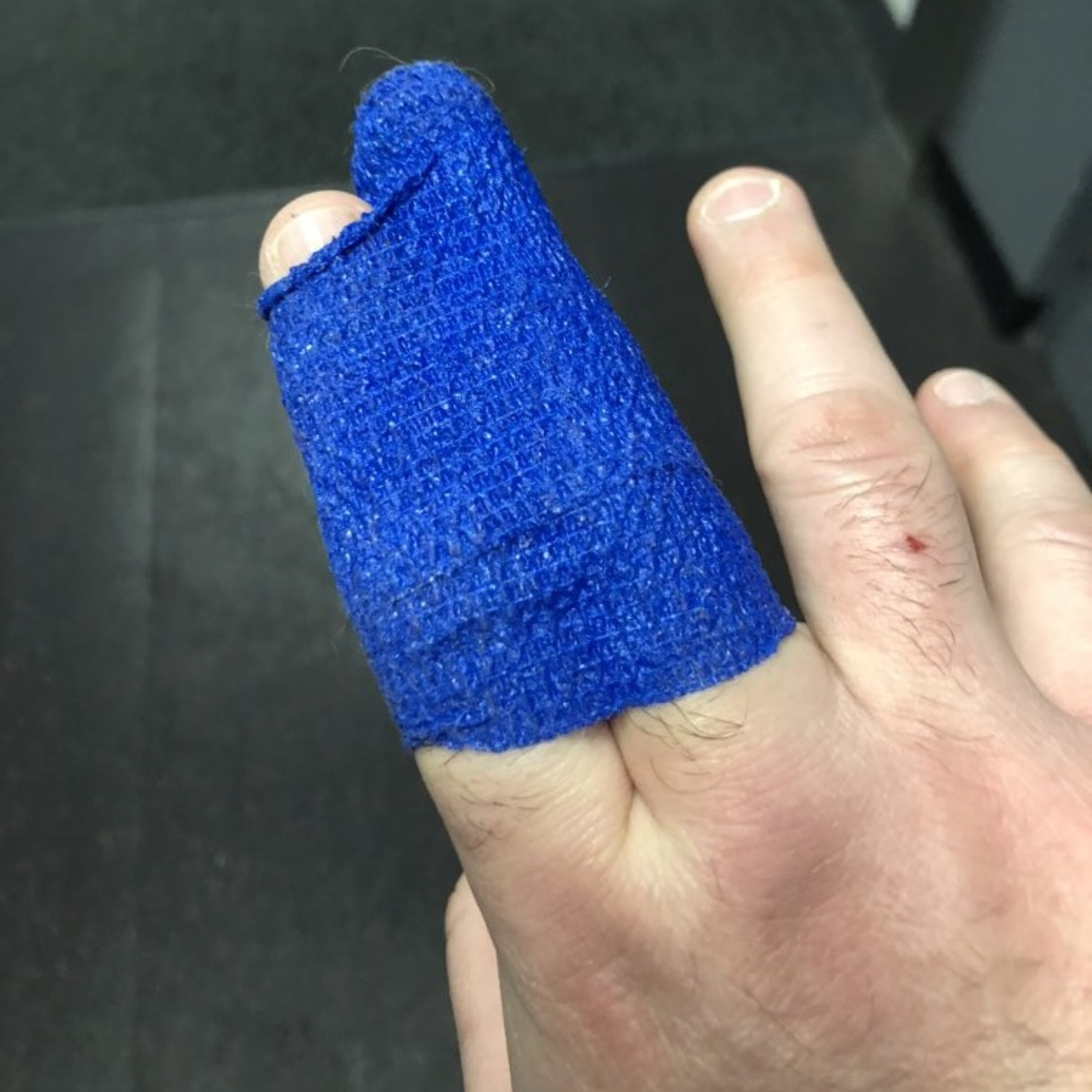 Scott Broke His Finger And Woman Have More Sex Toys Than Men episode artwork