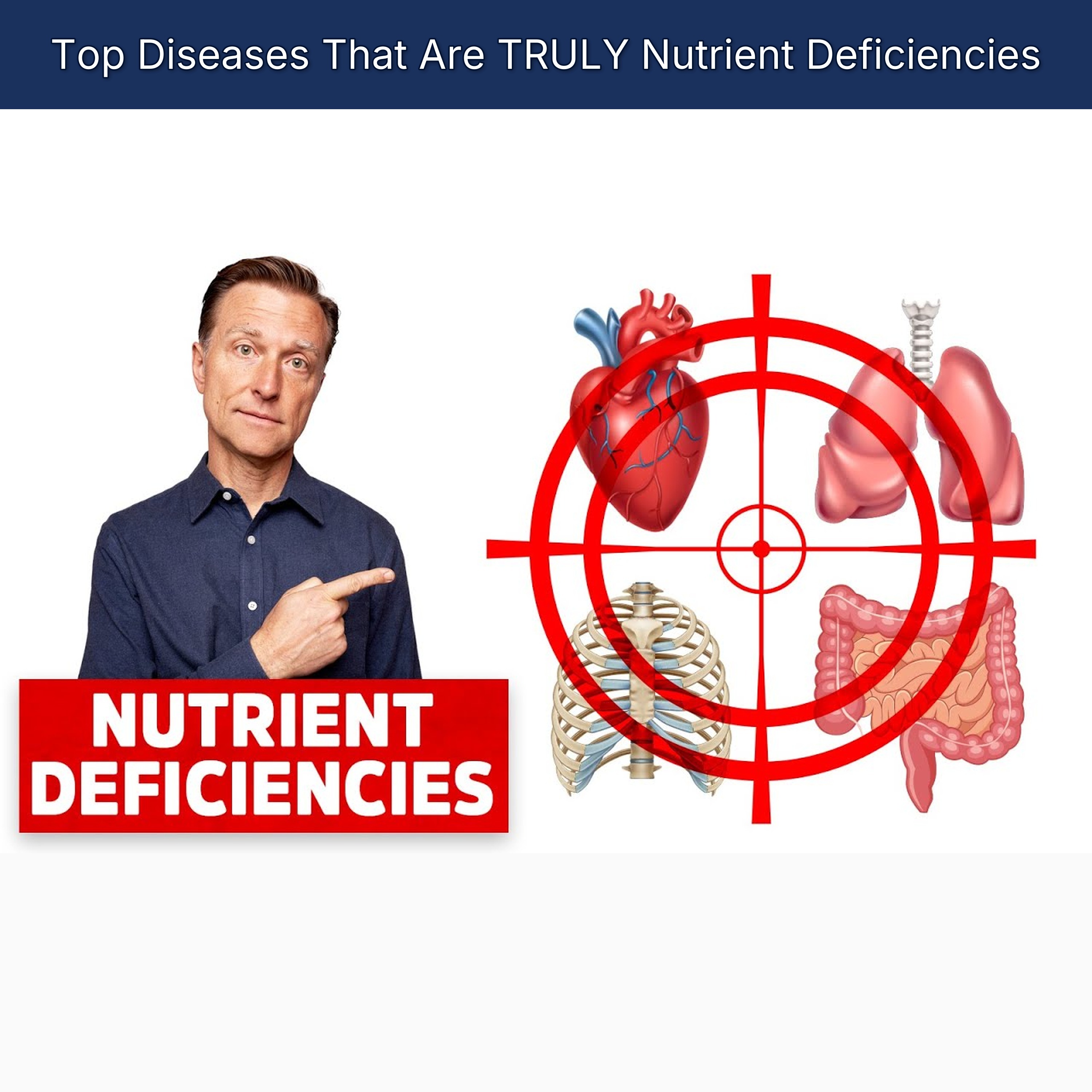 Top Diseases That Are TRULY Nutrient Deficiencies episode artwork