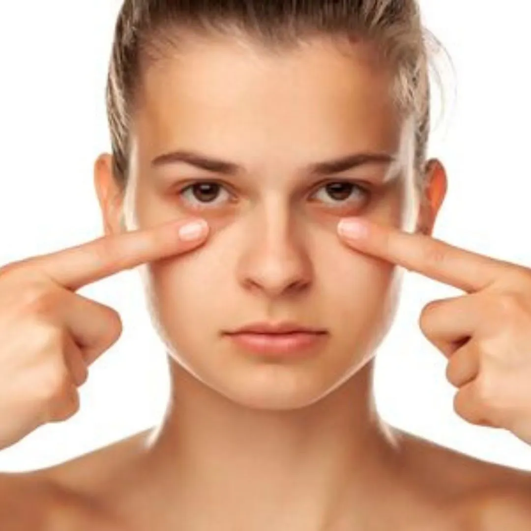 Que sont les cernes ?