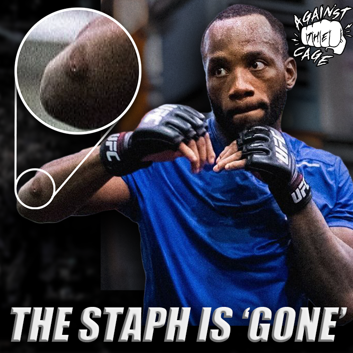 Leon Edwards claims he does NOT have staph ahead of Sean Brady fight | Against The Cage episode artwork