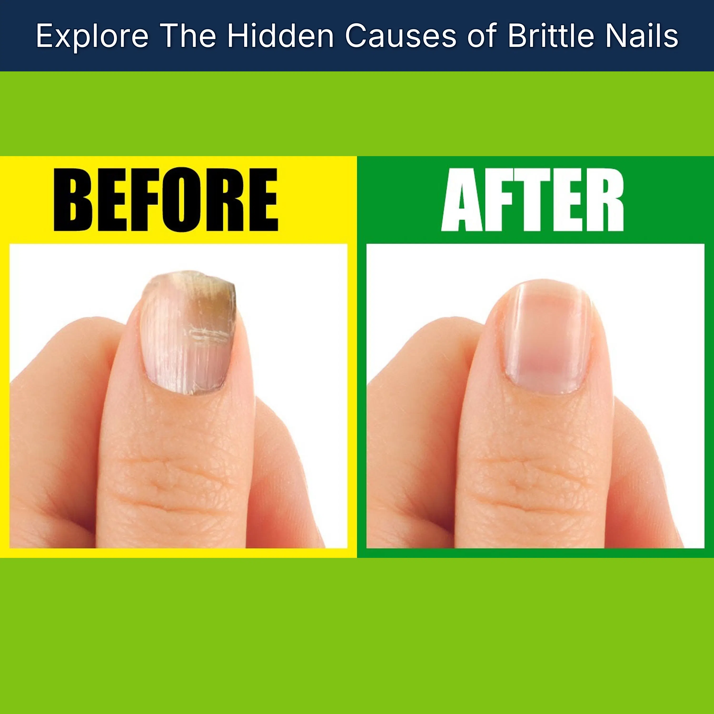 Explore The Hidden Causes of Brittle Nails