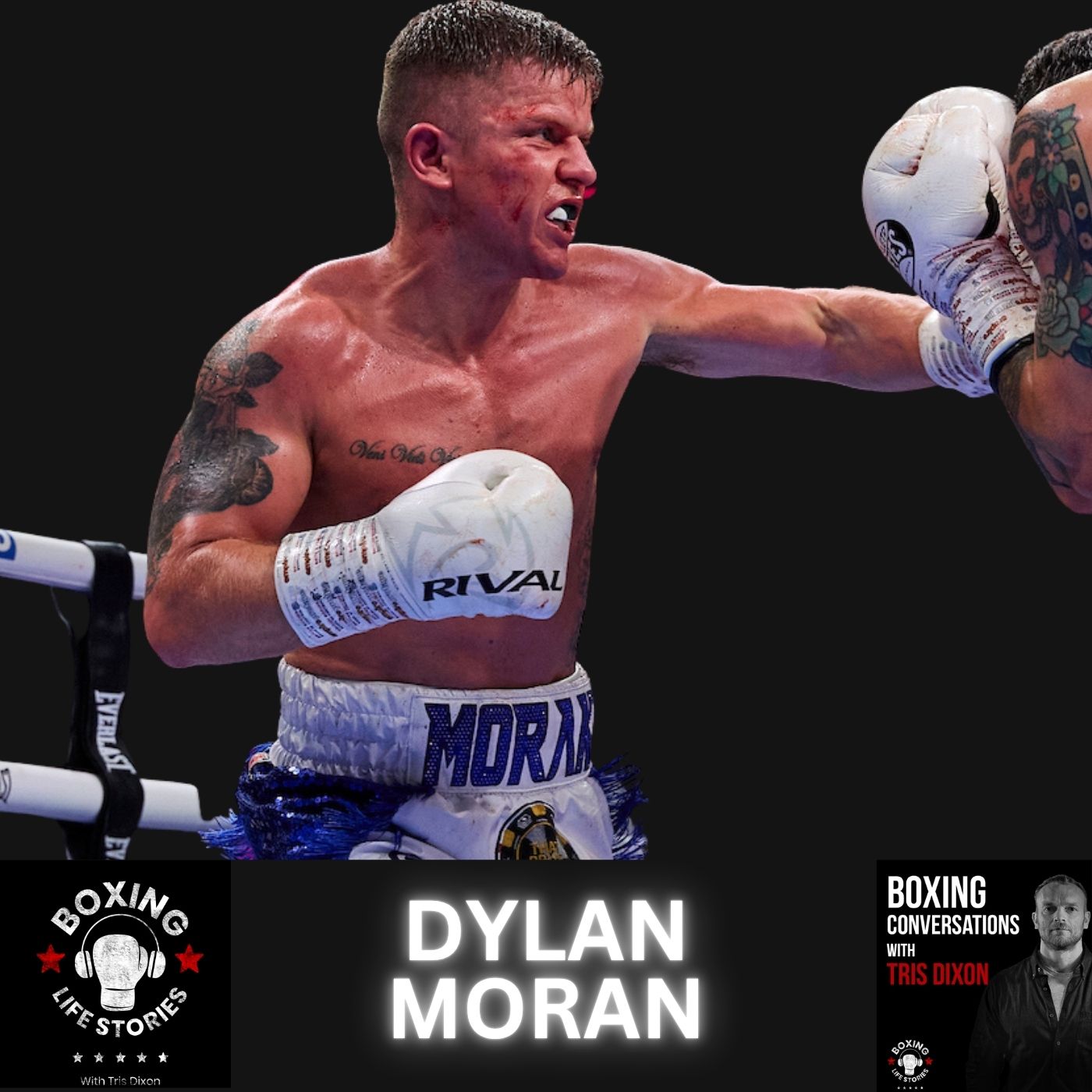 Dylan Moran On The Injury That's Retired Him, Tyrone McKenna Wars, Life After Boxing