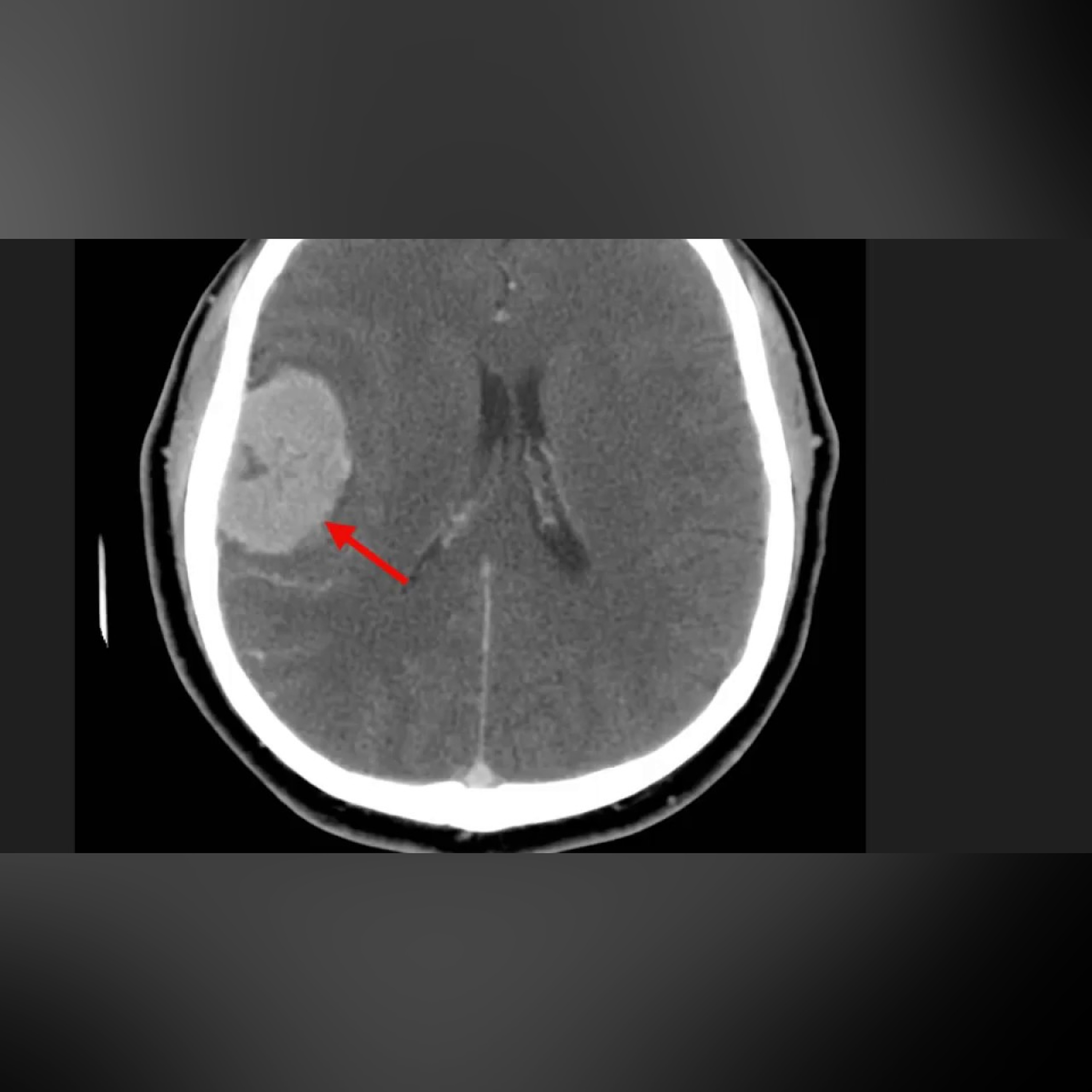 High Yield CT Scans (Part 2) || USMLE episode artwork