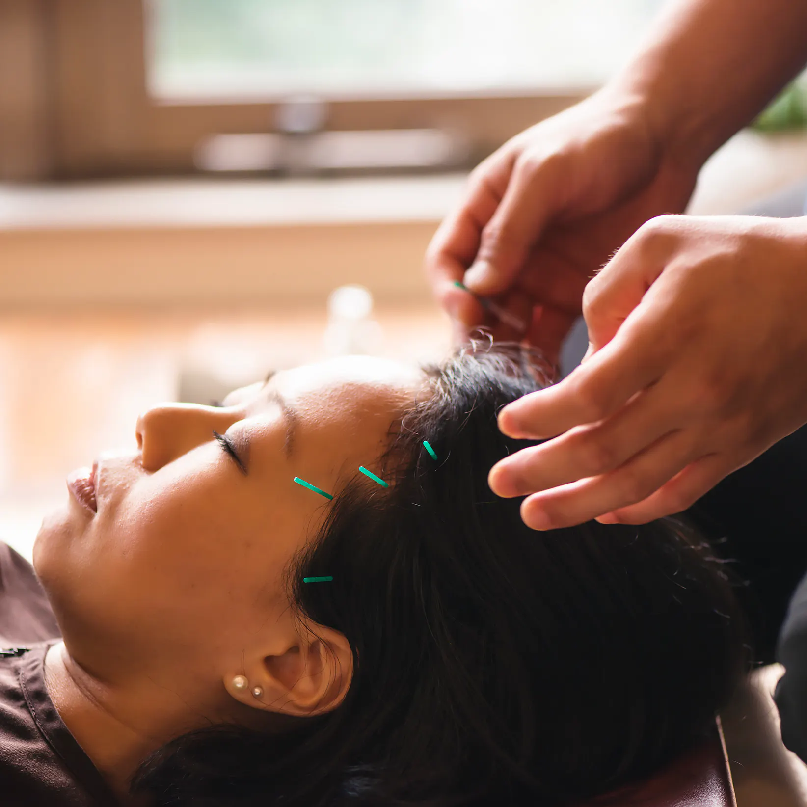 Acupuncture Helps Ease Chemo Brain episode artwork