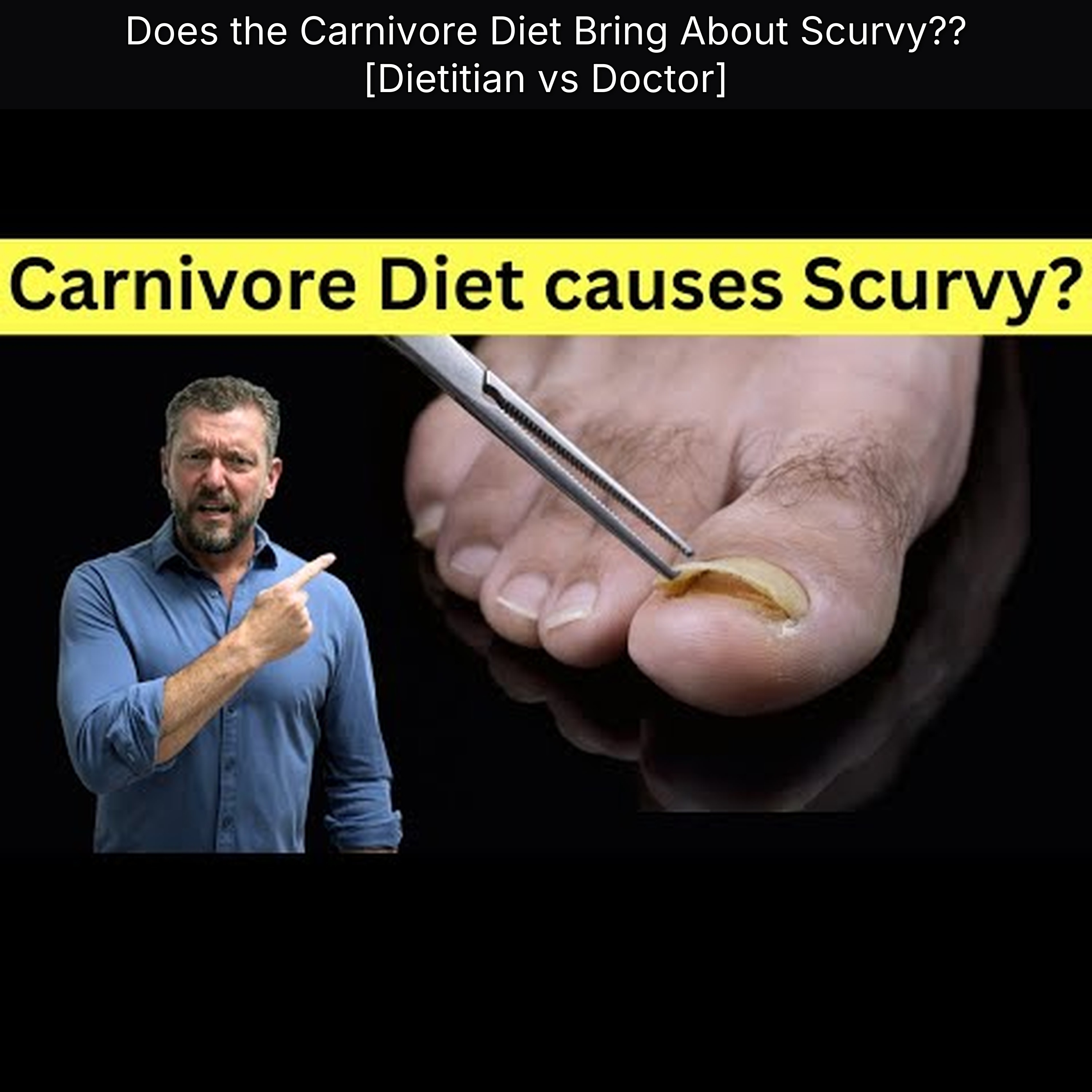 Does the Carnivore Diet Bring About Scurvy?? [Dietitian vs Doctor] episode artwork