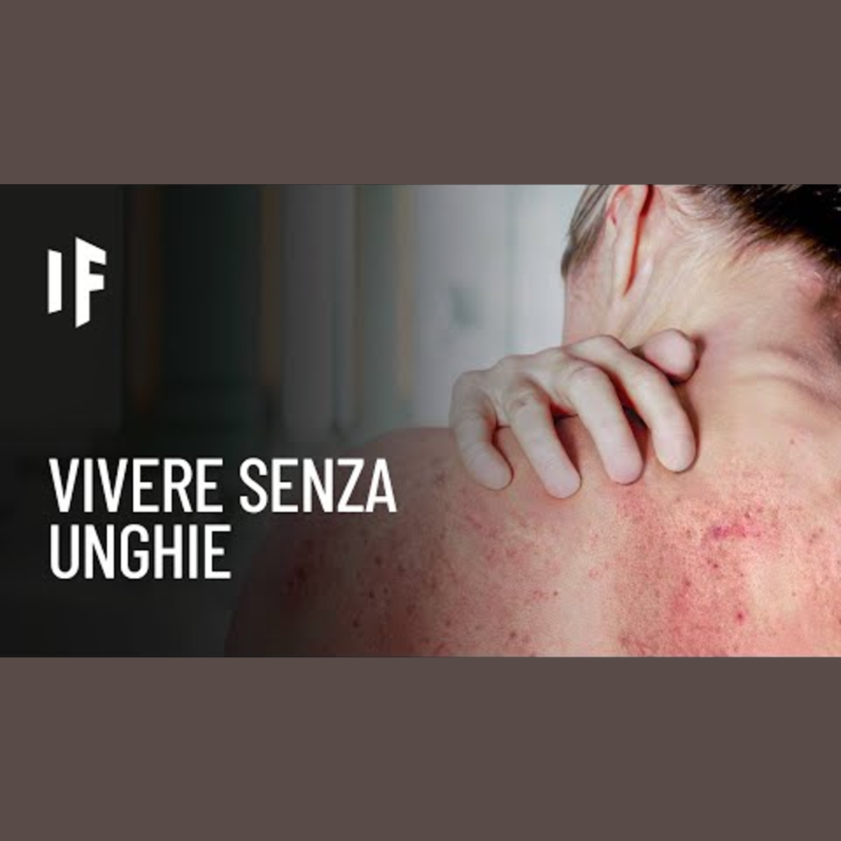 E se gli esseri umani non avessero le unghie? episode artwork