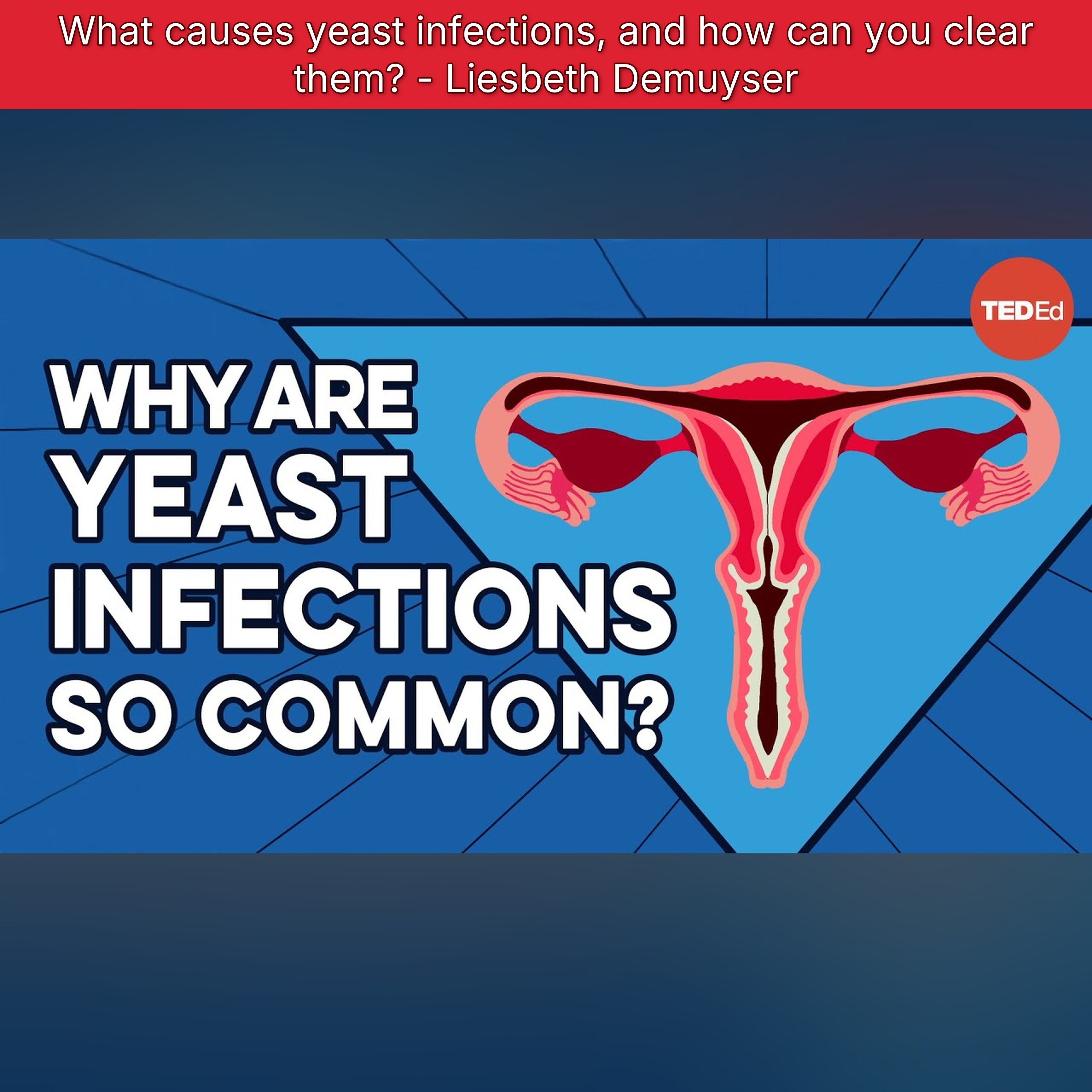 What causes yeast infections, and how can you clear them? - Liesbeth Demuyser episode artwork