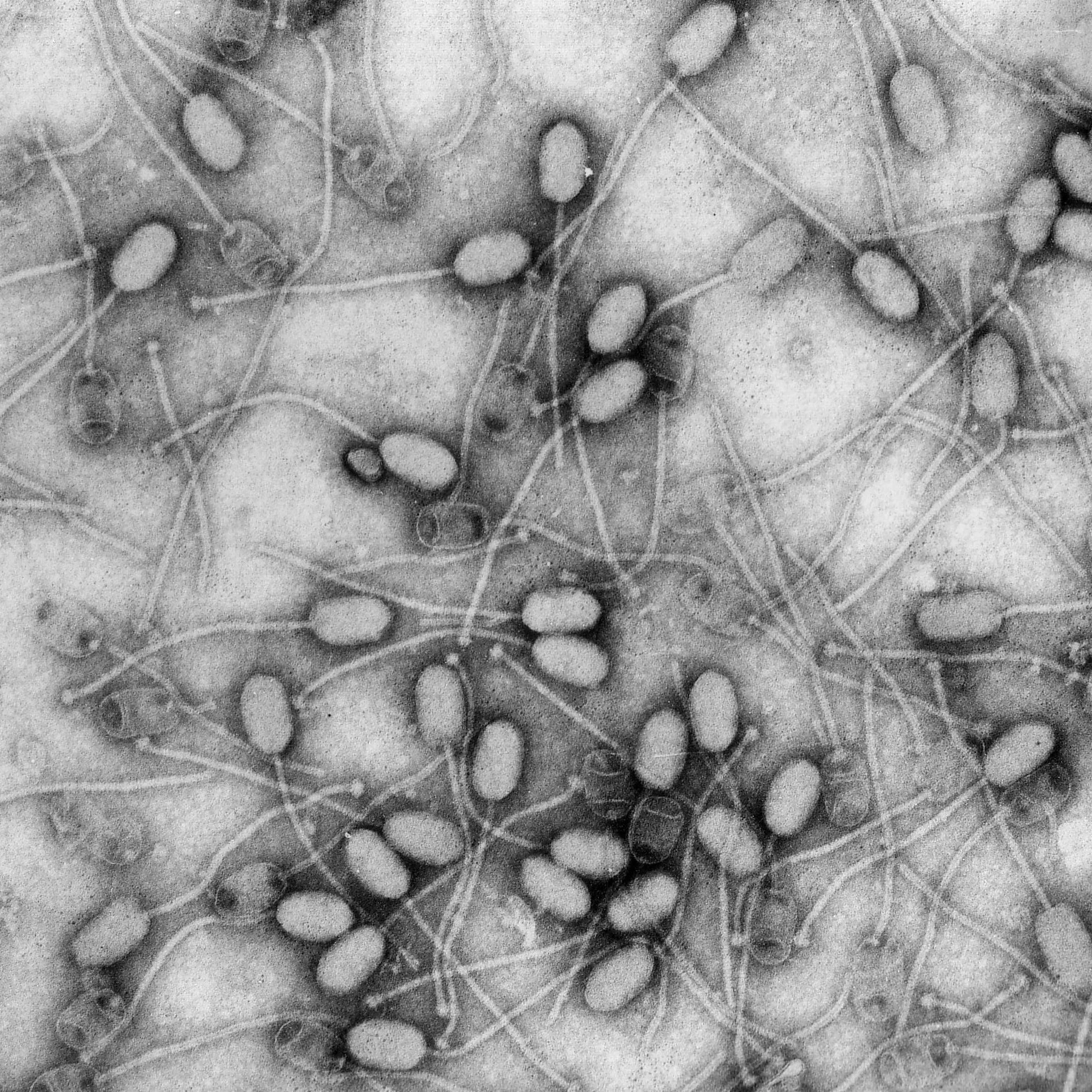 Qu'est-ce que la phagothérapie ?