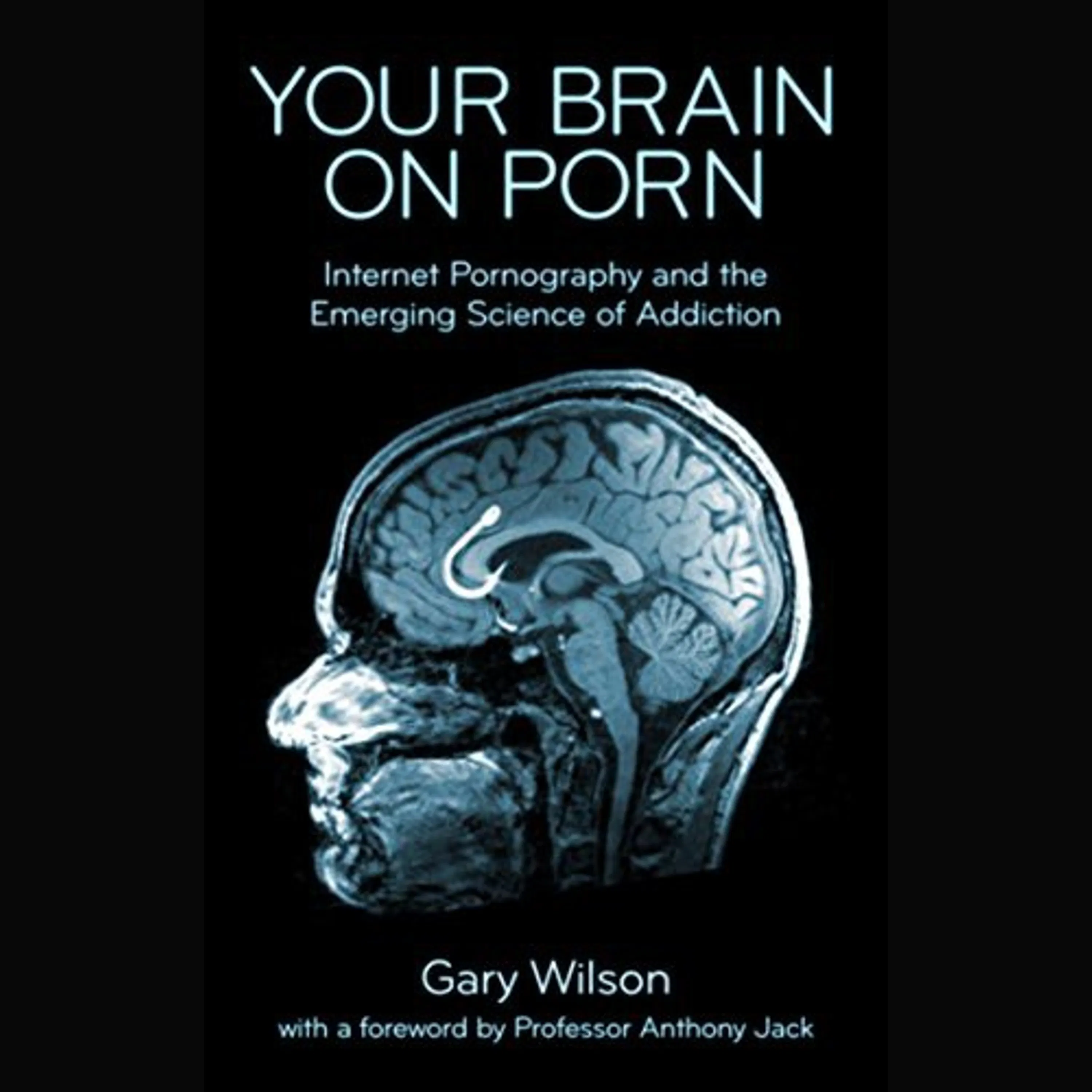 Your Brain on Porn Sammanfattning | Gary Wilson episode artwork