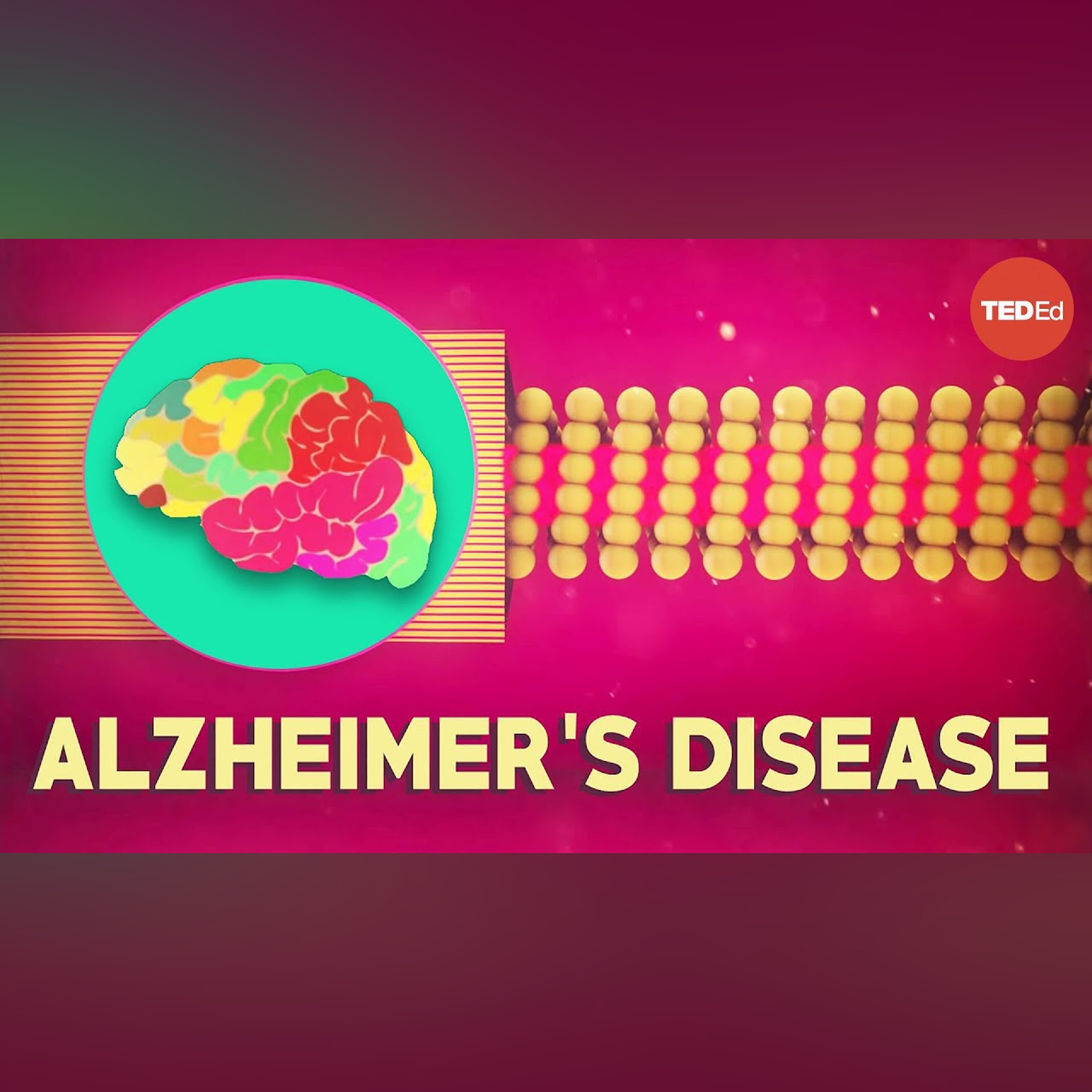 What is Alzheimer's disease? - Ivan Seah Yu Jun