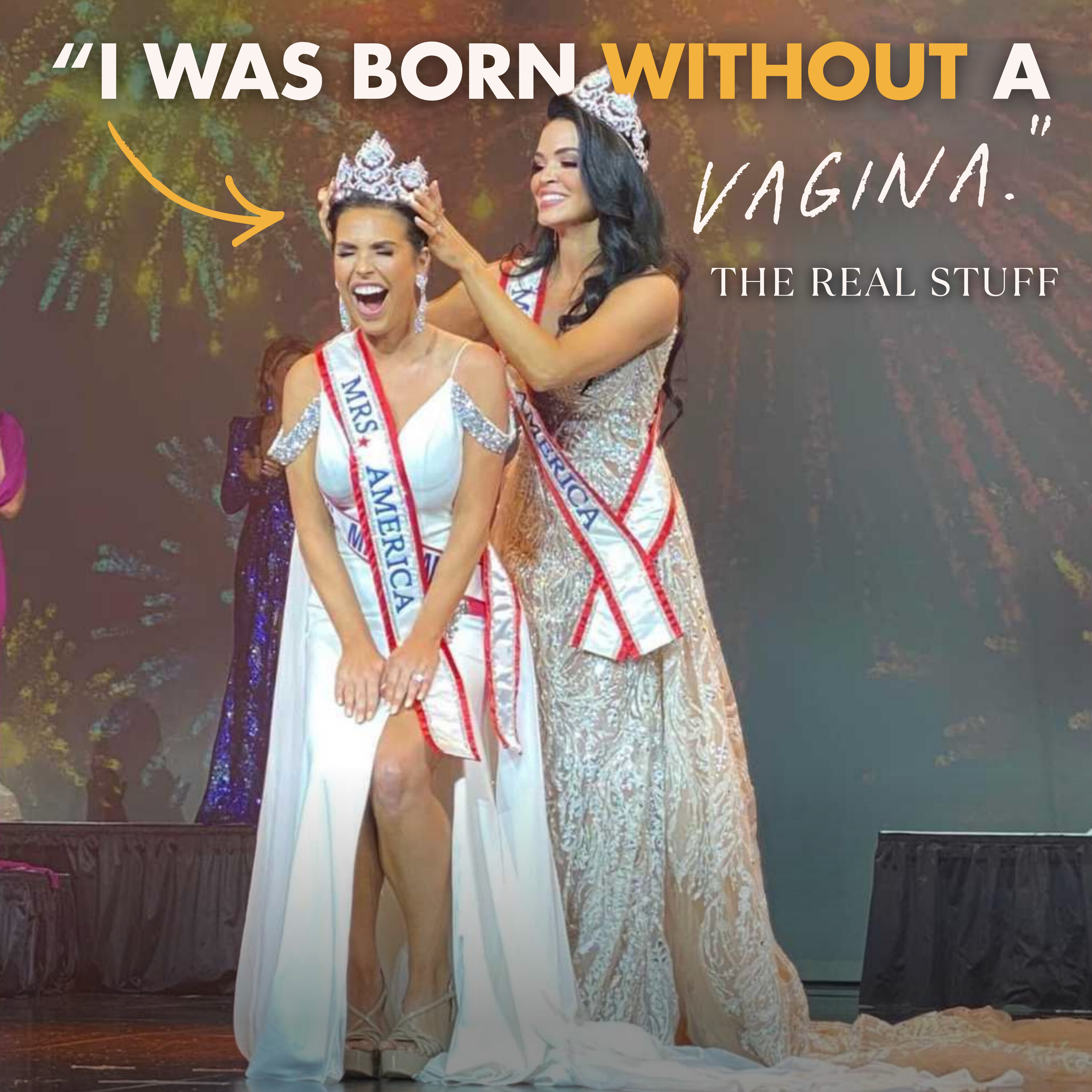 The Woman Born Without a Vagina