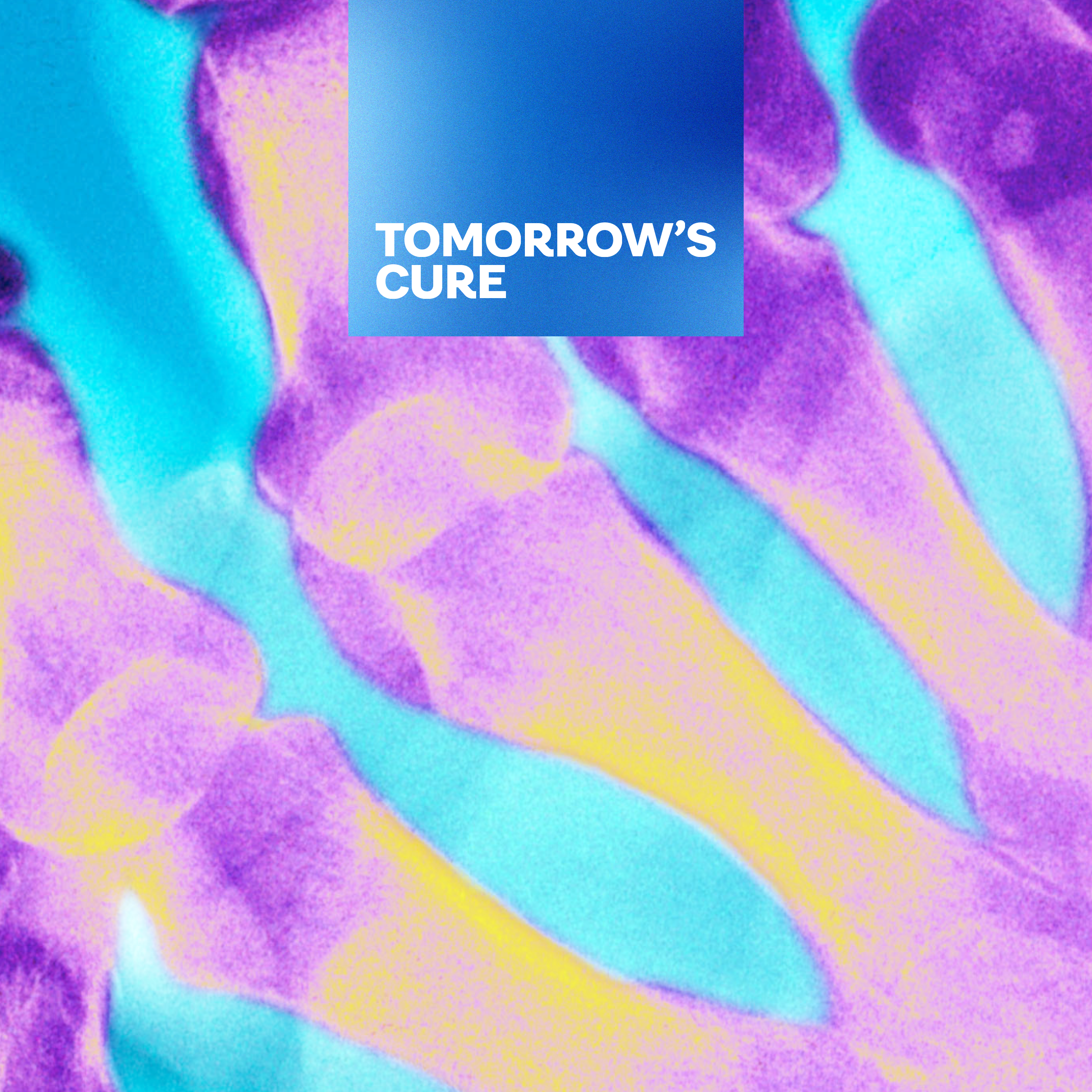 Thumbnail for "Predictive Medicine: Rethinking Rheumatoid Arthritis".