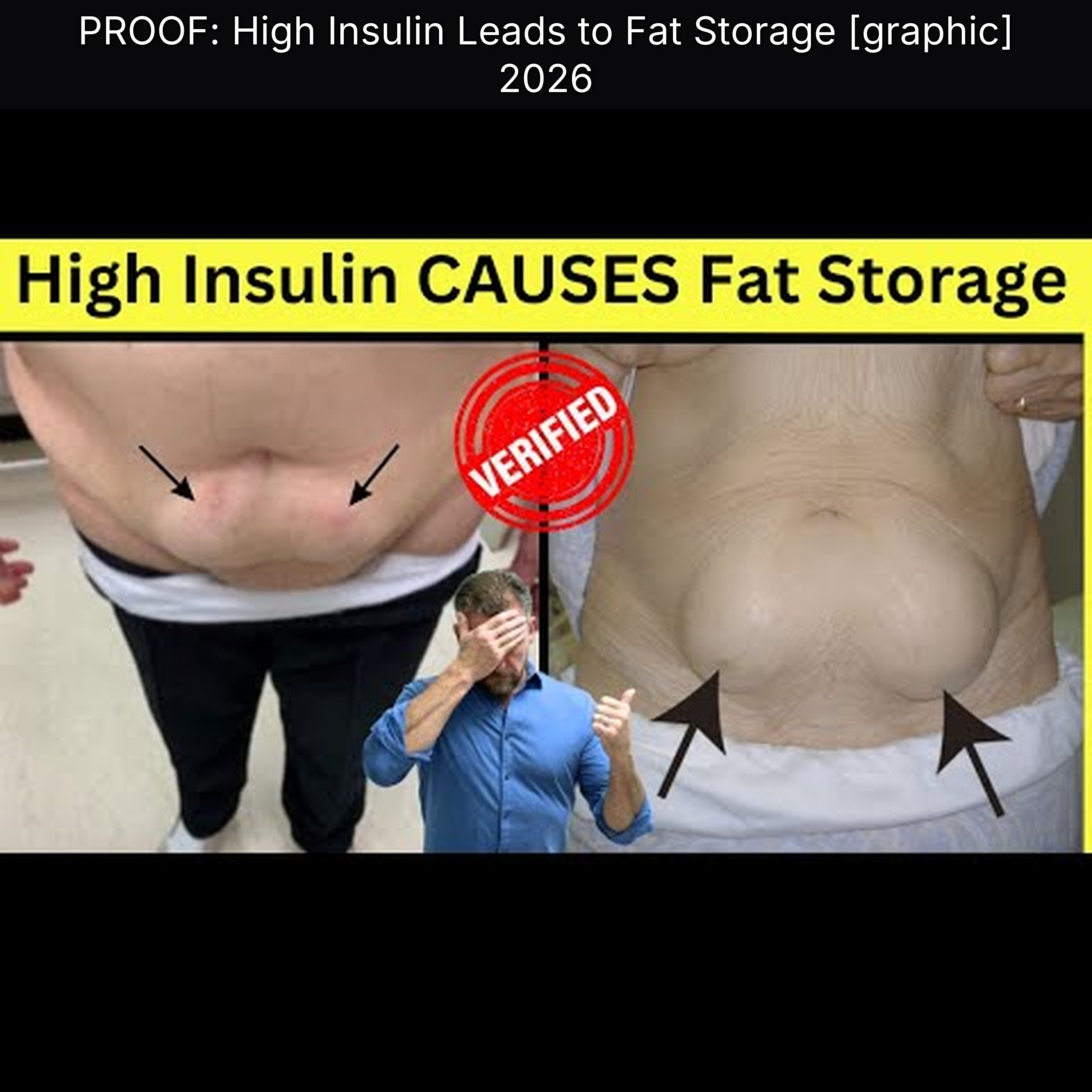 PROOF: High Insulin Leads to Fat Storage [graphic] 2026 episode artwork