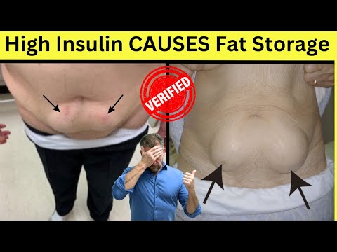 PROOF: High Insulin causes Fat Storage [graphic] 2026