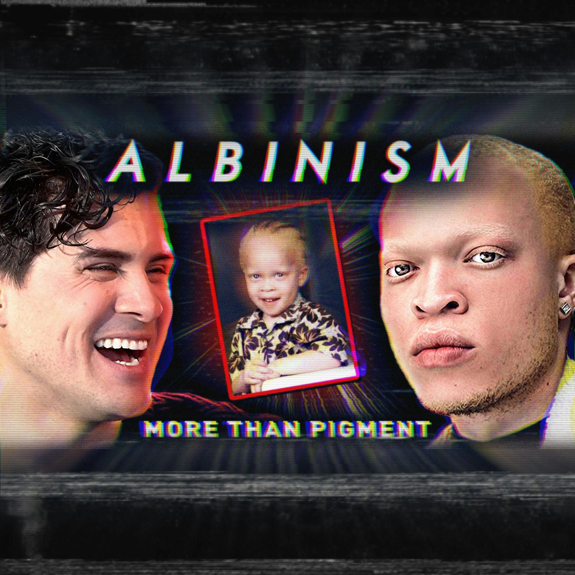 I Spent A Day With People w/ ALBINISM