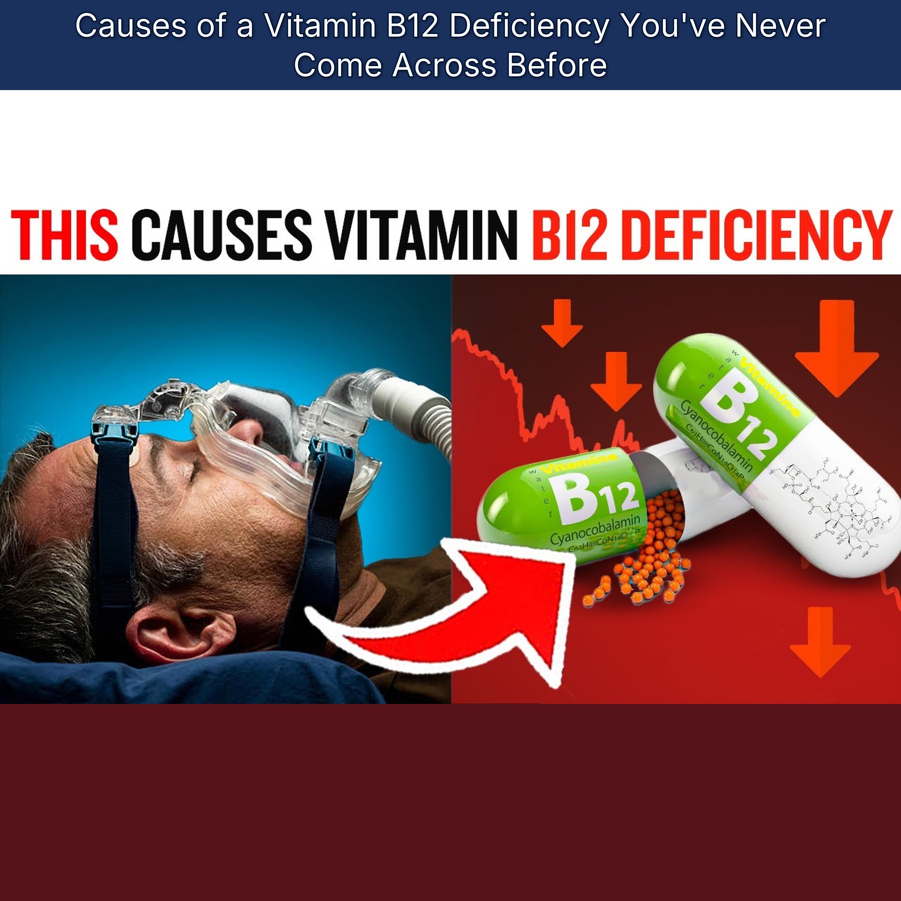 Causes of a Vitamin B12 Deficiency You've Never Come Across Before episode artwork