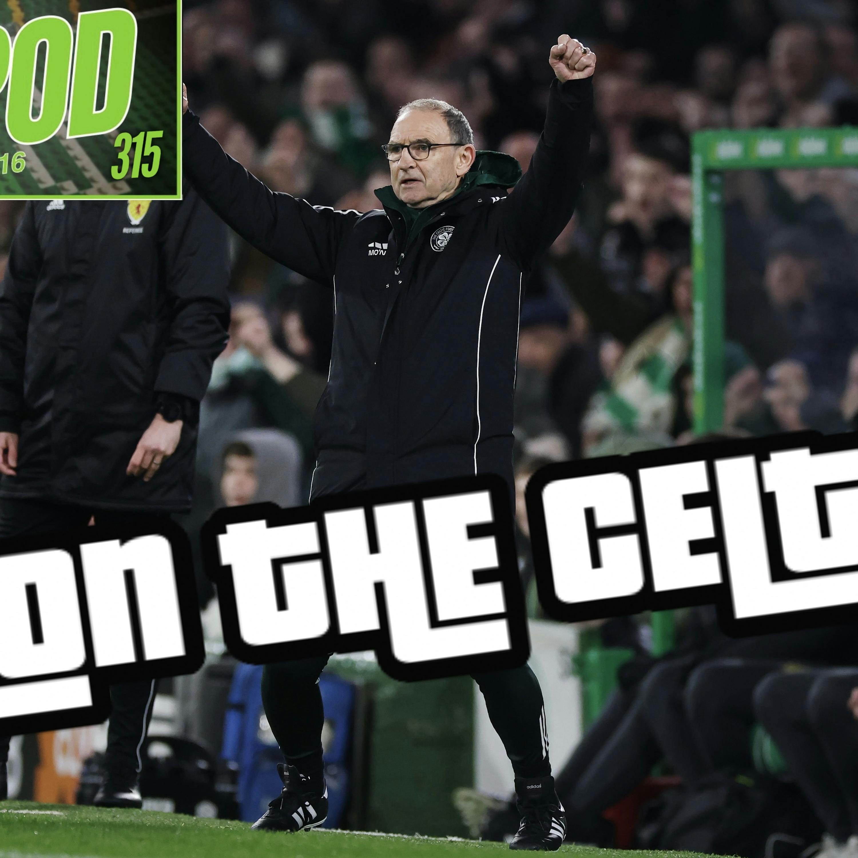 GIGPOD EP 315: MON THE CELTS