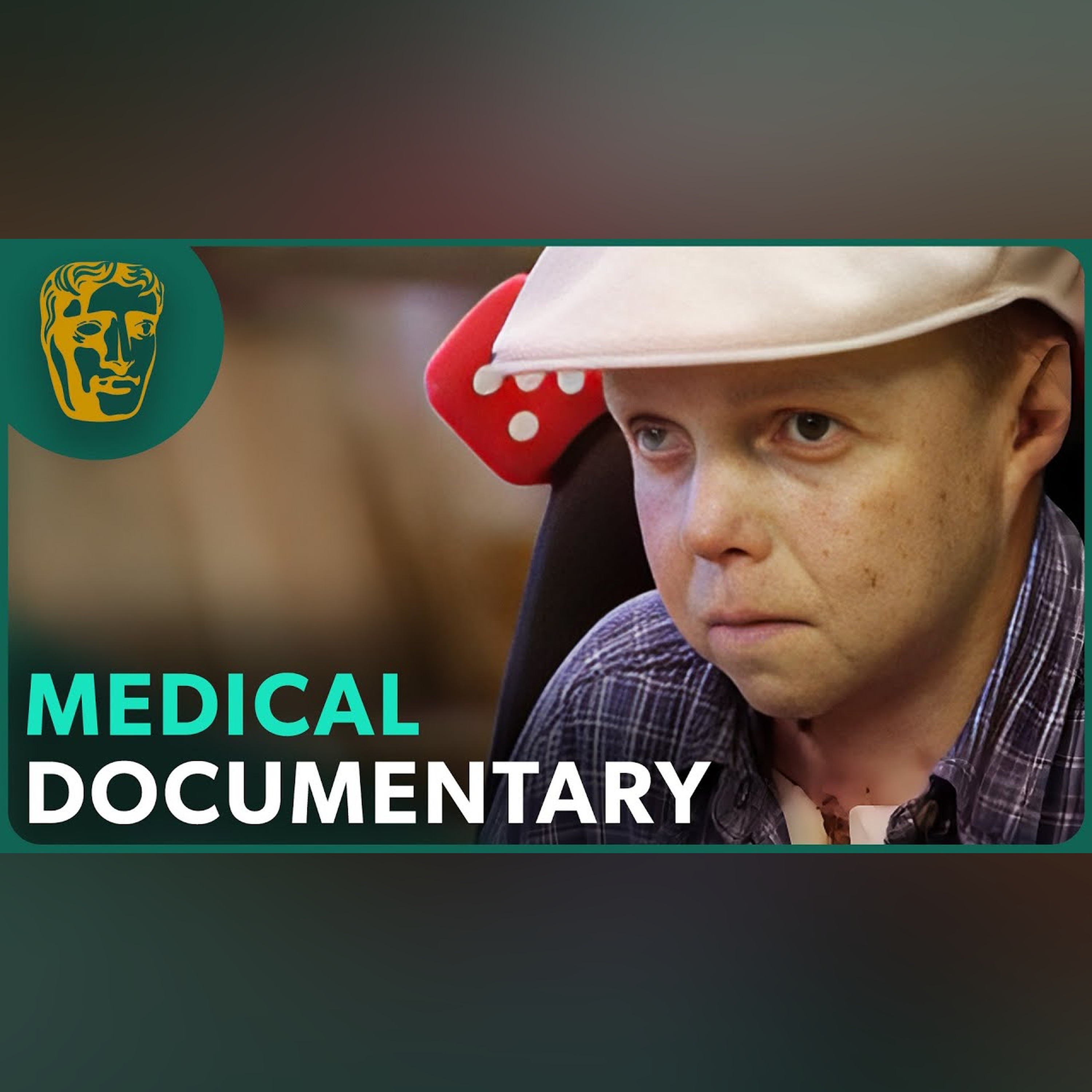 Jonny Kennedy: The Man Whose Skin Fell Off (BAFTA-AWARD WINNING DOCUMENTARY) | Real Stories