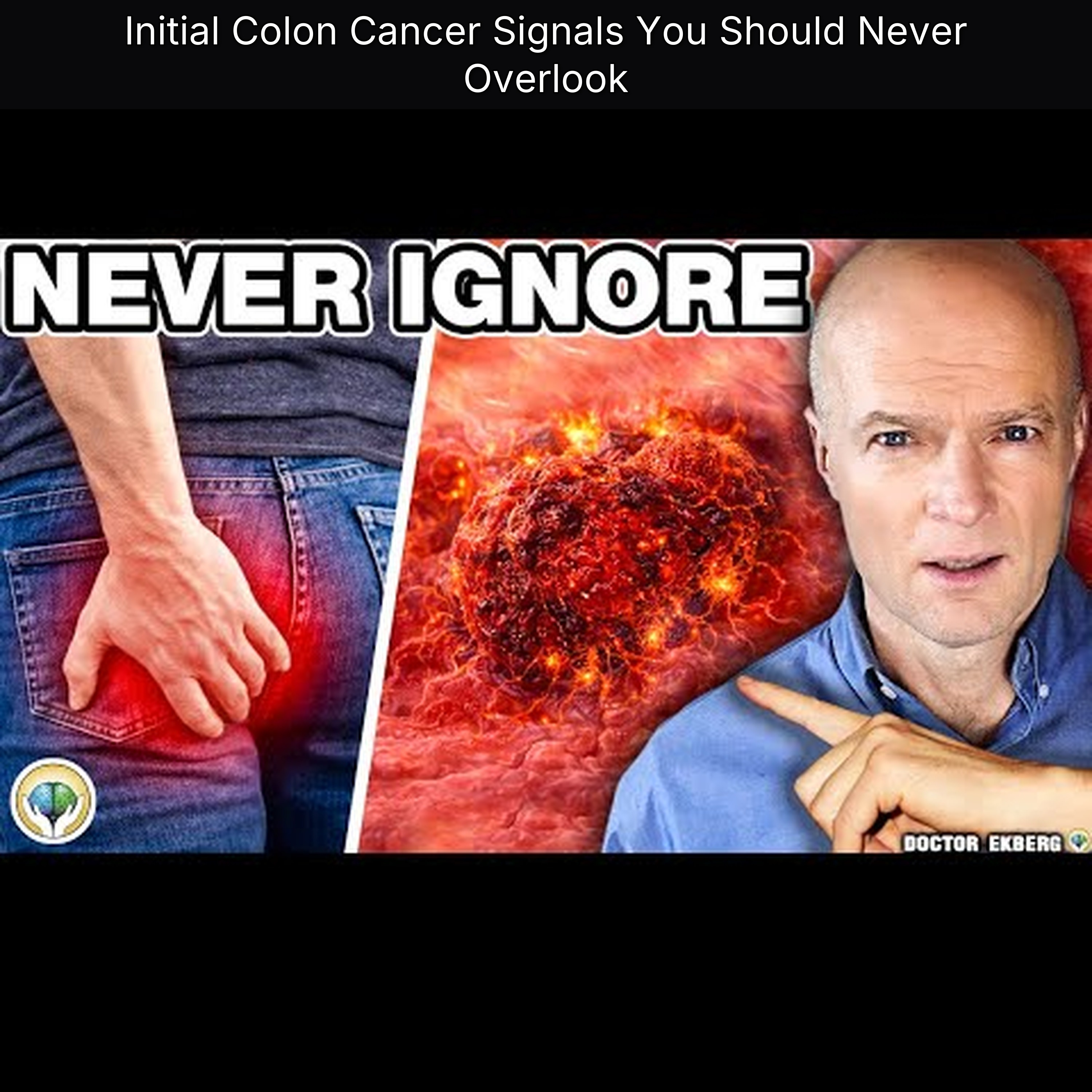 Initial Colon Cancer Signals You Should Never Overlook