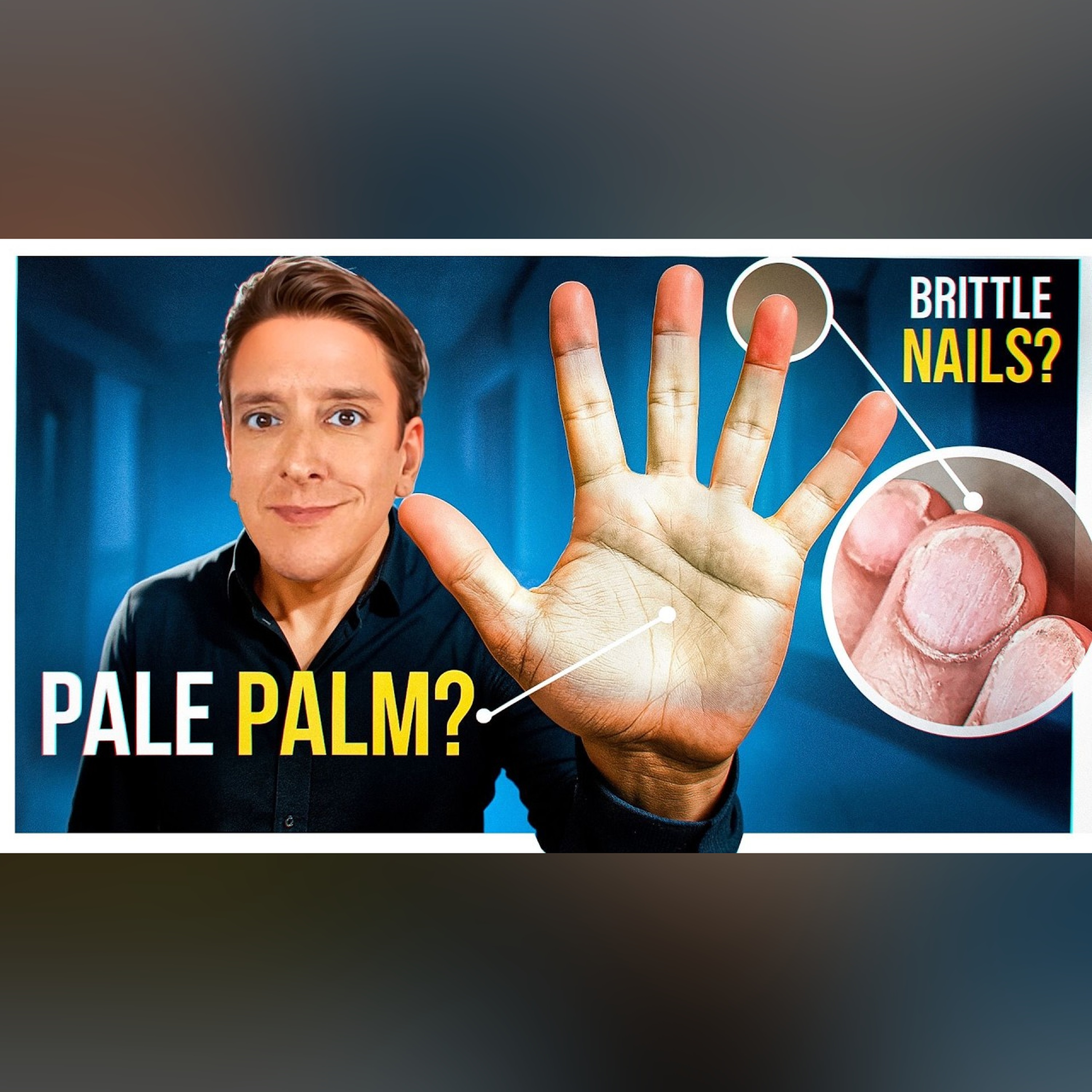 Nutrient Deficiencies Revealed by your Hands episode artwork