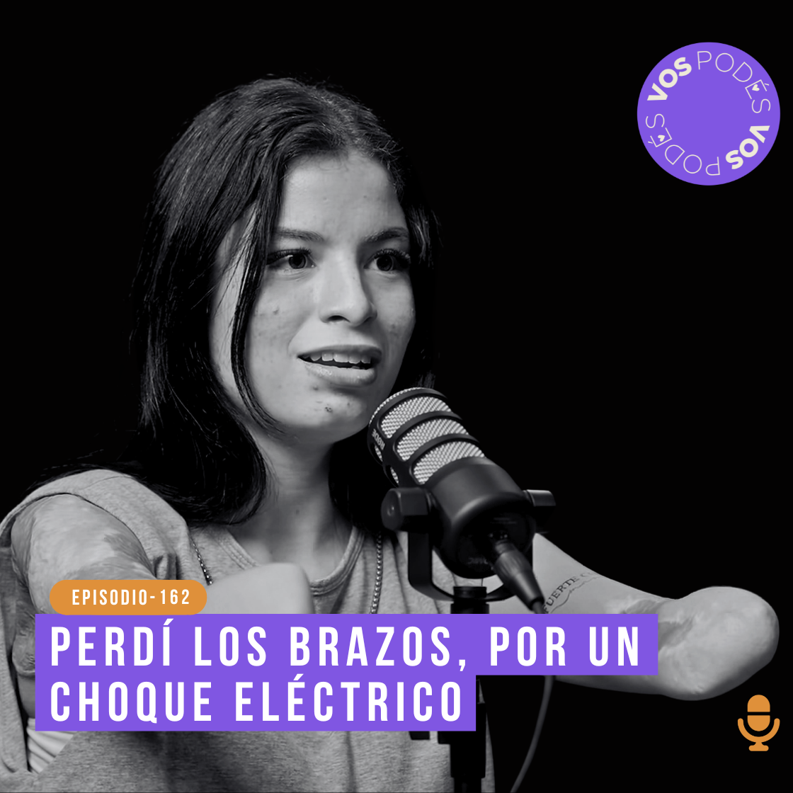 Perdí los brazos por un choque eléctrico - invitada: Karol Bastidas