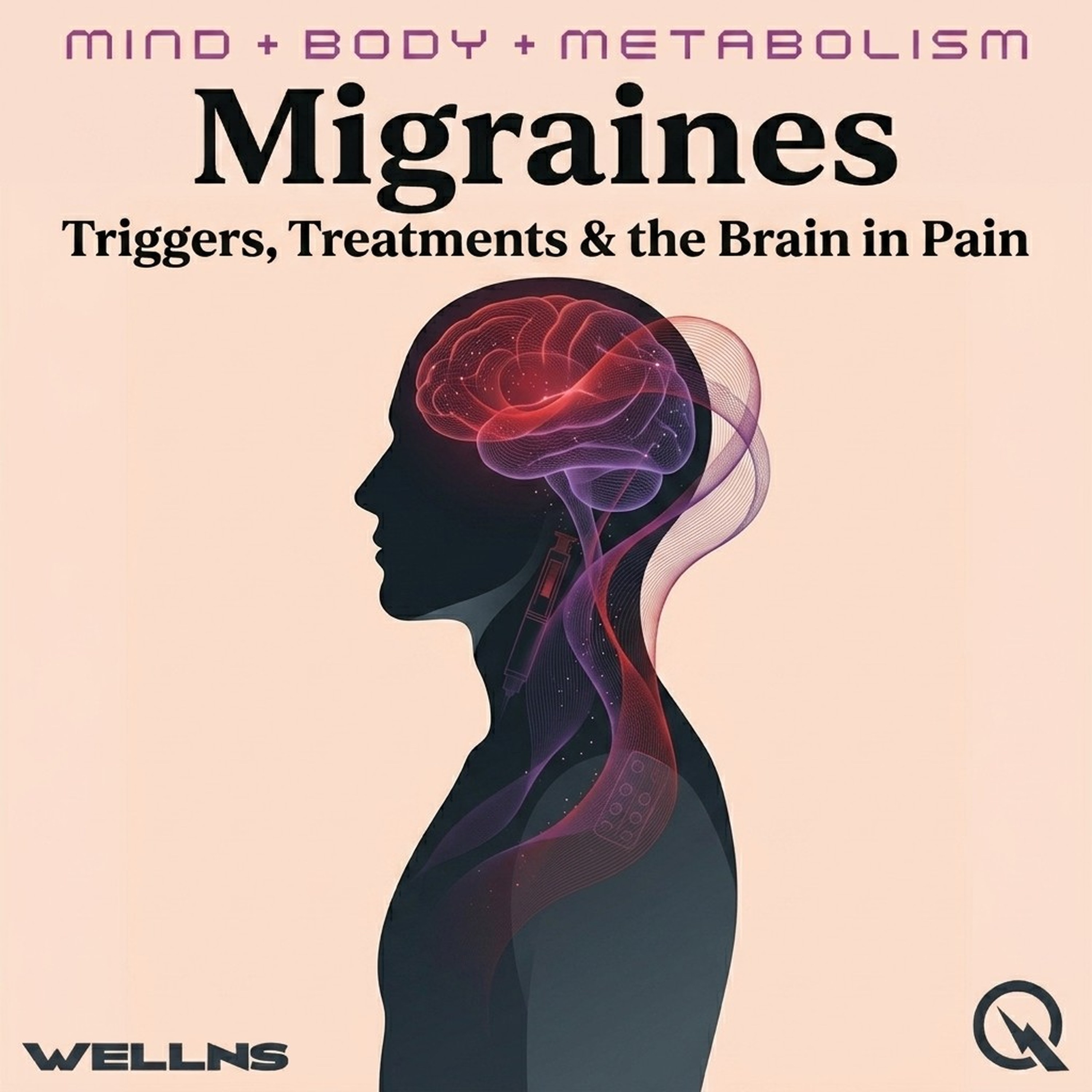 Migraines