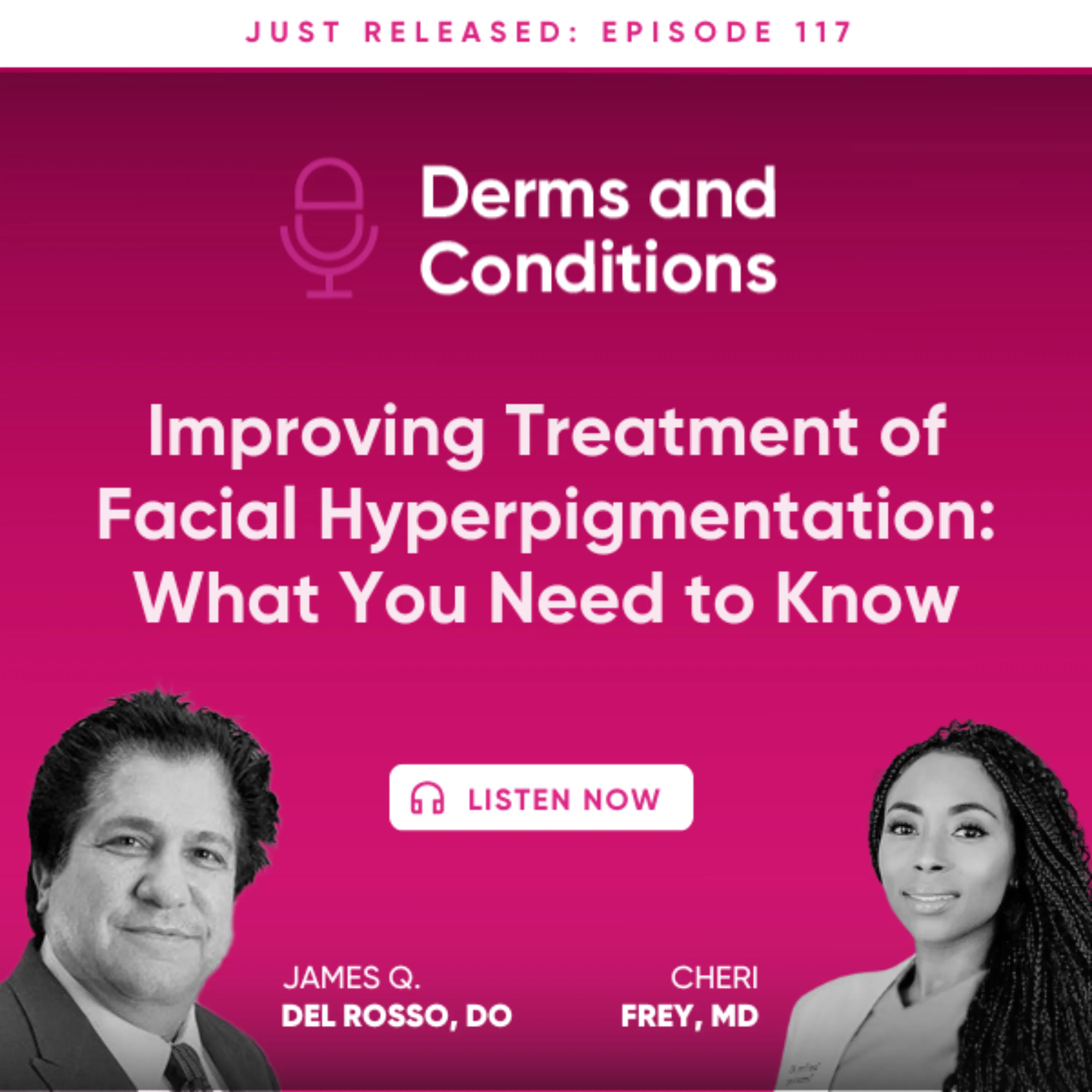 Improving Treatment of Facial Hyperpigmentation: What You Need To Know