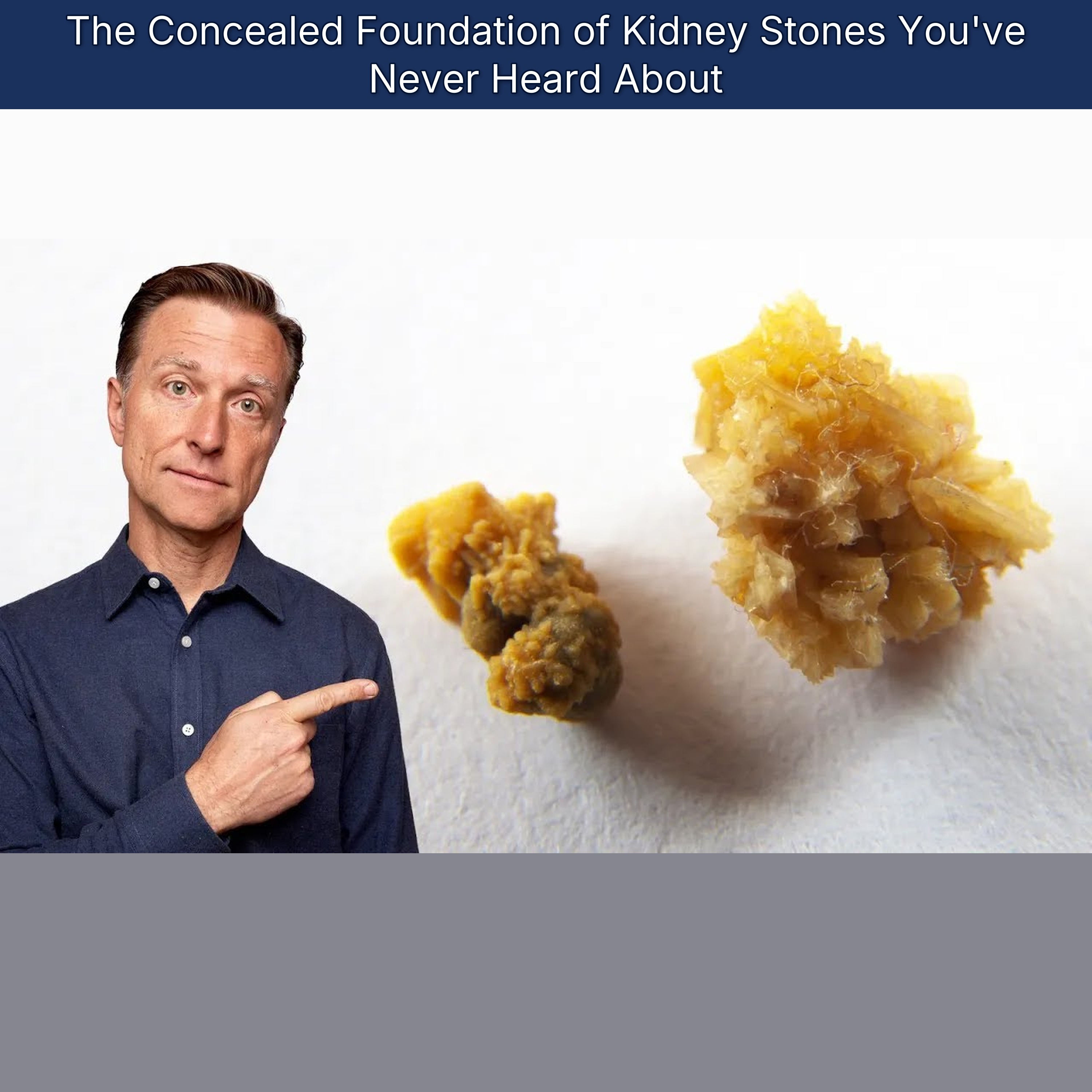 The Concealed Foundation of Kidney Stones You've Never Heard About