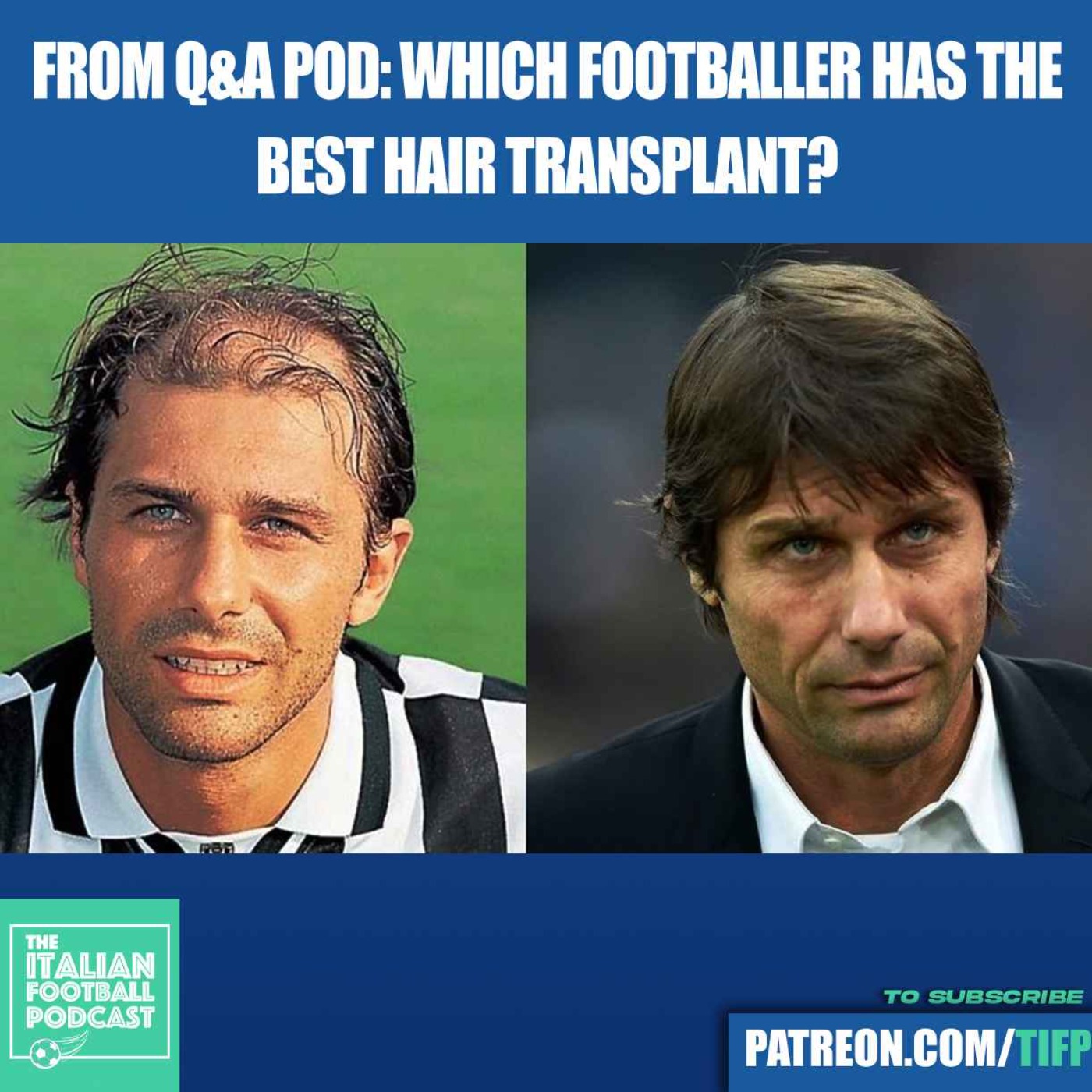 Which Footballer Has The Best Hair Transplant? From David Beckham To Antonio Conte