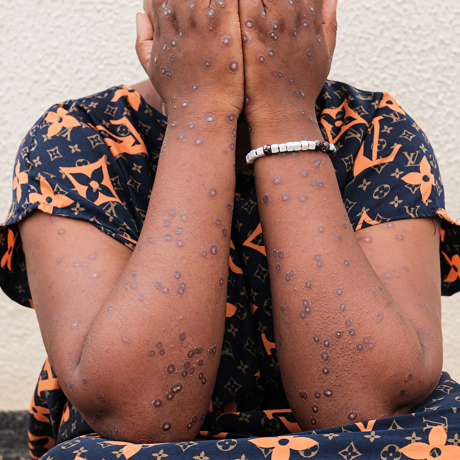 The Path Toward Eliminating Neglected Tropical Diseases episode artwork