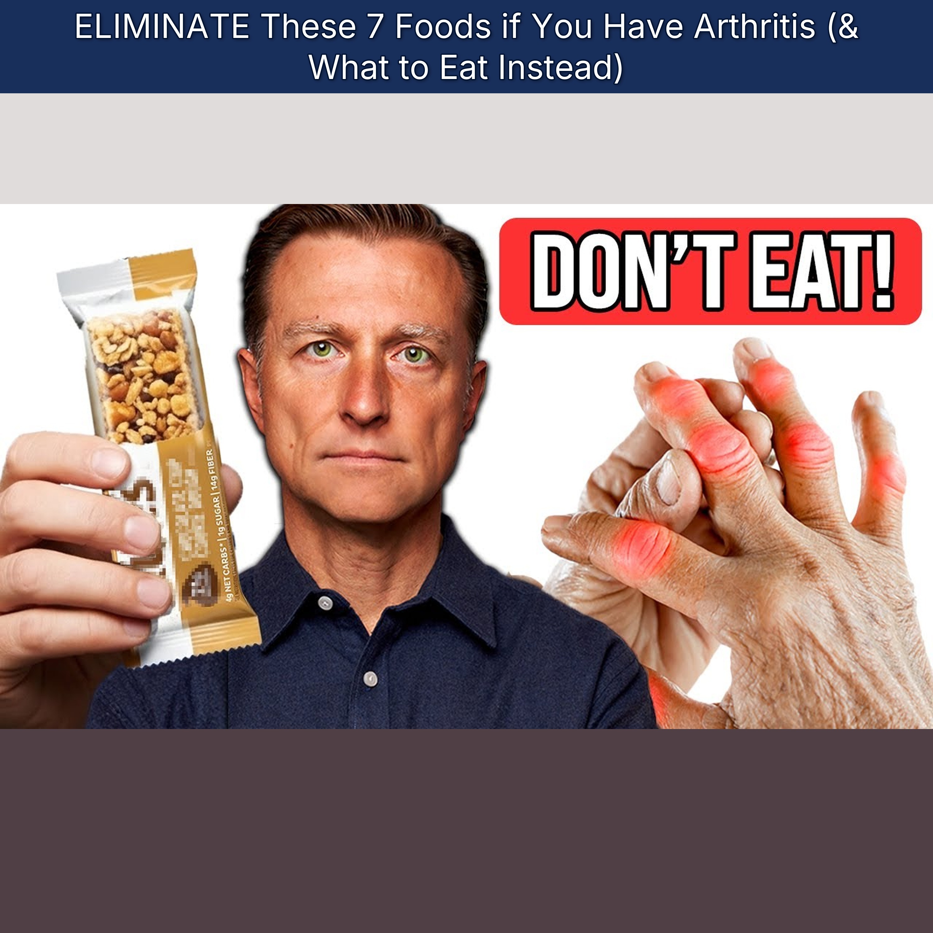 ELIMINATE These 7 Foods if You Have Arthritis (& What to Eat Instead)