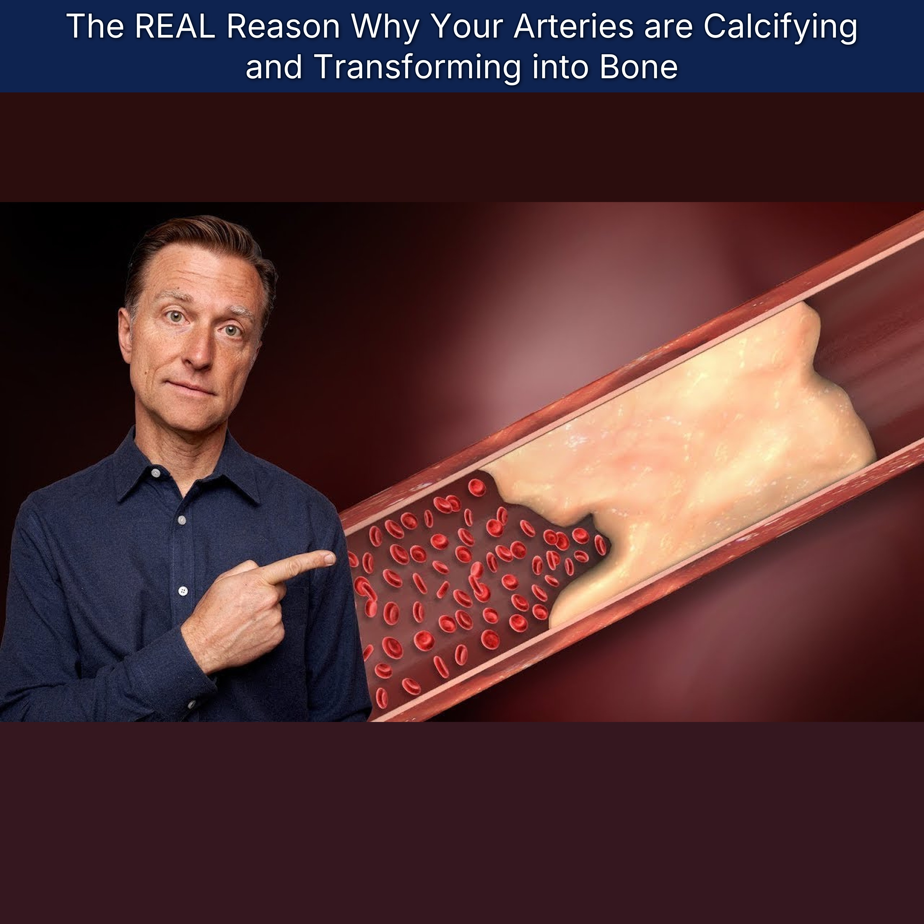 The REAL Reason Why Your Arteries are Calcifying and Transforming into Bone episode artwork