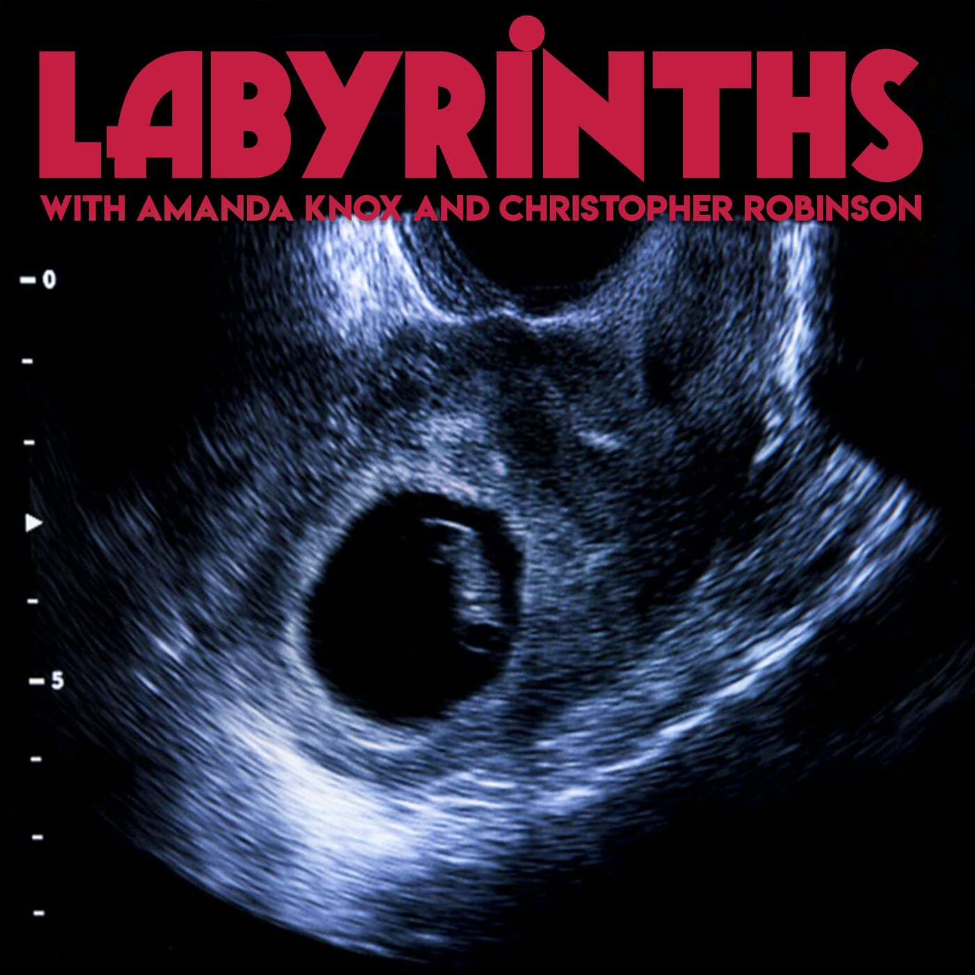 #25 - Infertility Part 1: No heartbeat