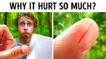 Why Paper Cuts Are So Painful (And Other Surprising Facts)