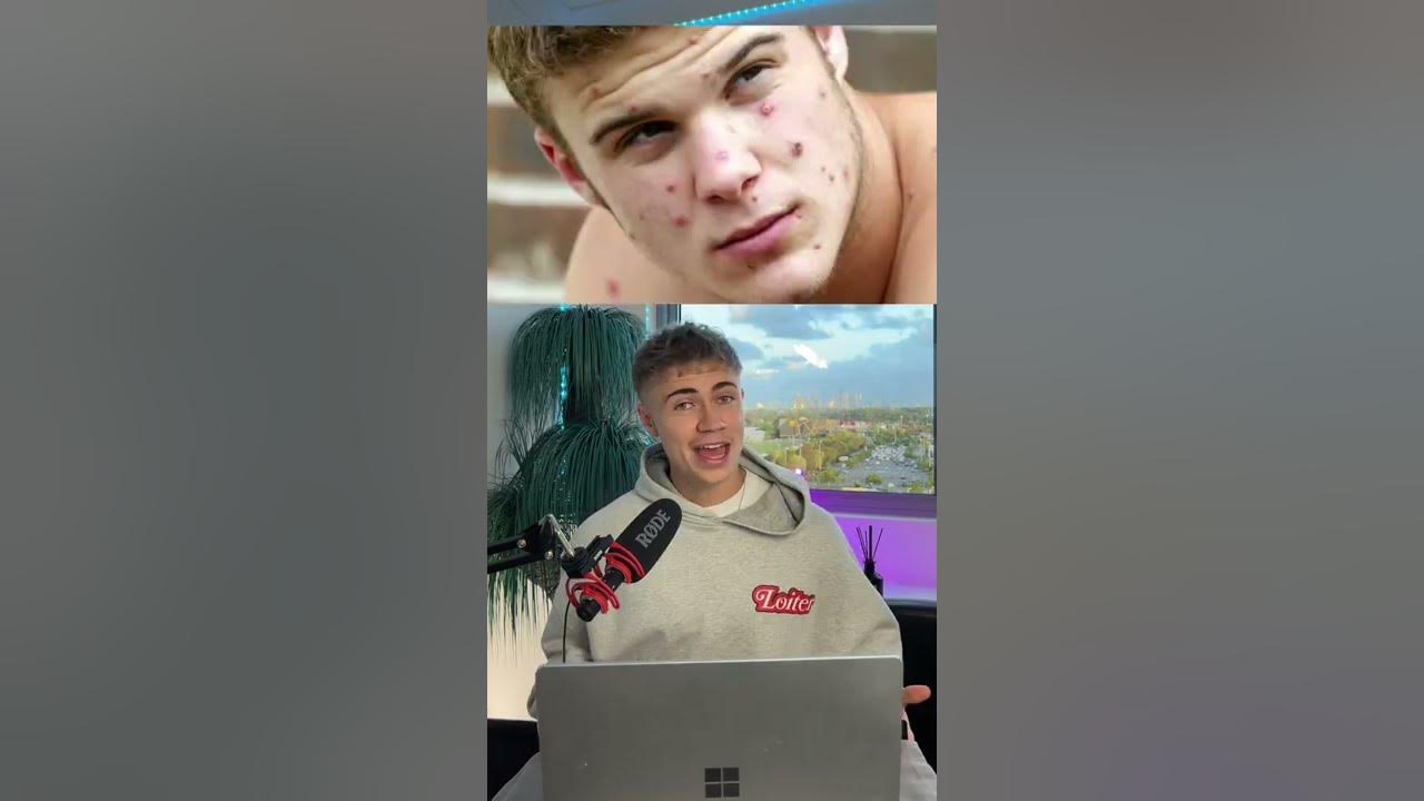 Monkeypox, the next pandemic? | Dylan Page