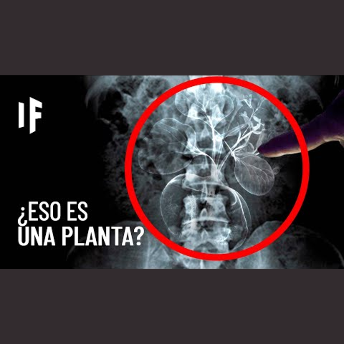 ¿Qué pasaría si una semilla germinara en tu estómago? episode artwork