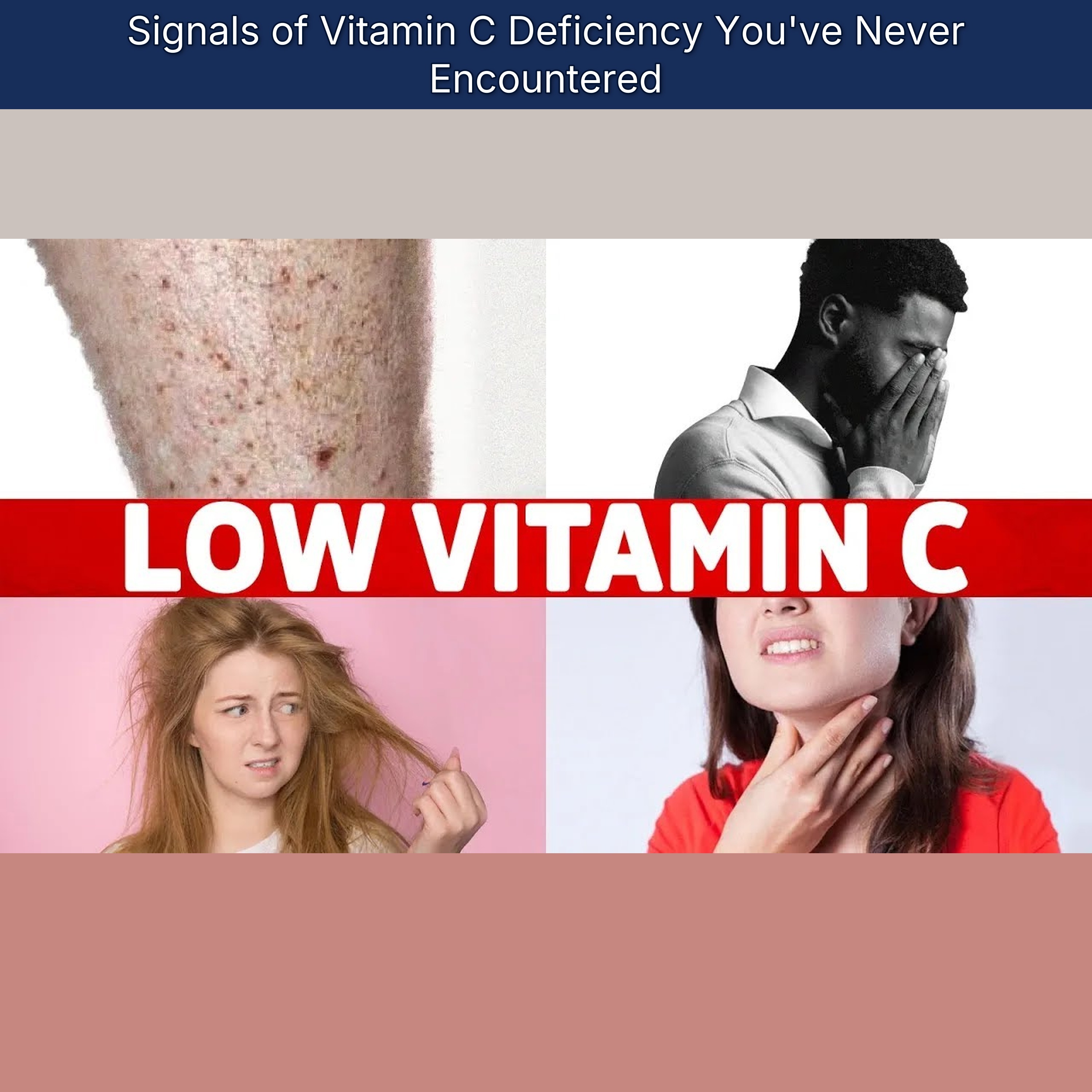Signals of Vitamin C Deficiency You've Never Encountered episode artwork