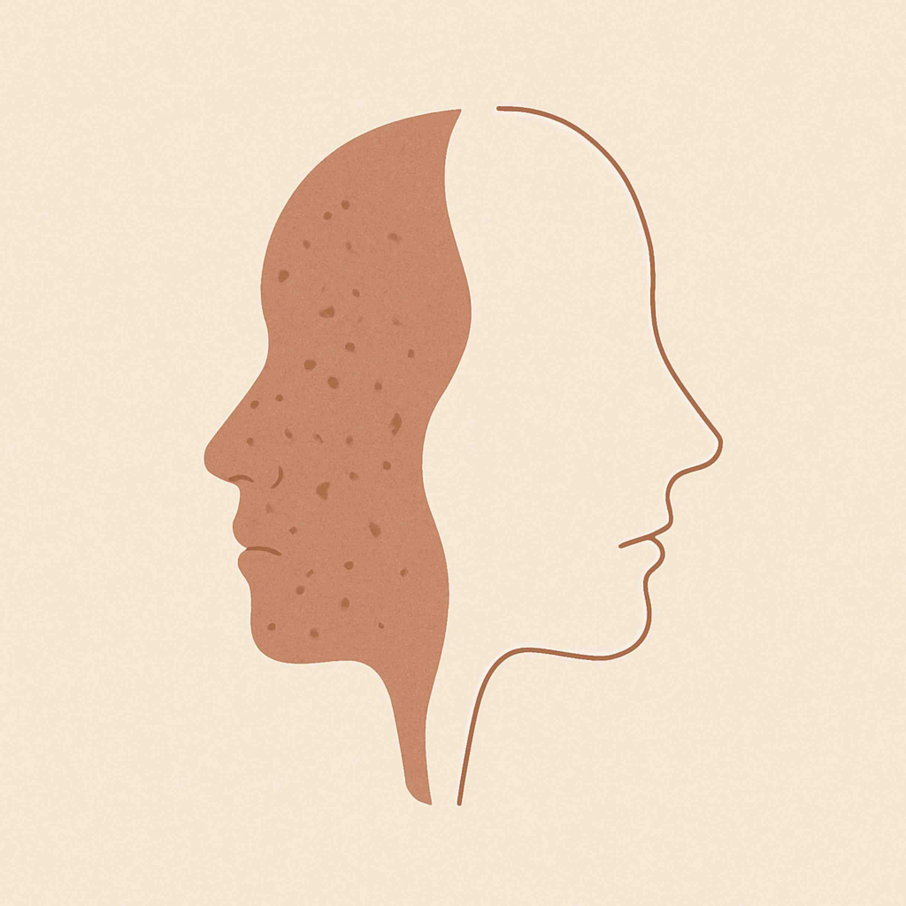 How Acne Made Me More Frugal by Jess Chua with Budgets Are Sexy on Lessons in Simplicity and Self-Care