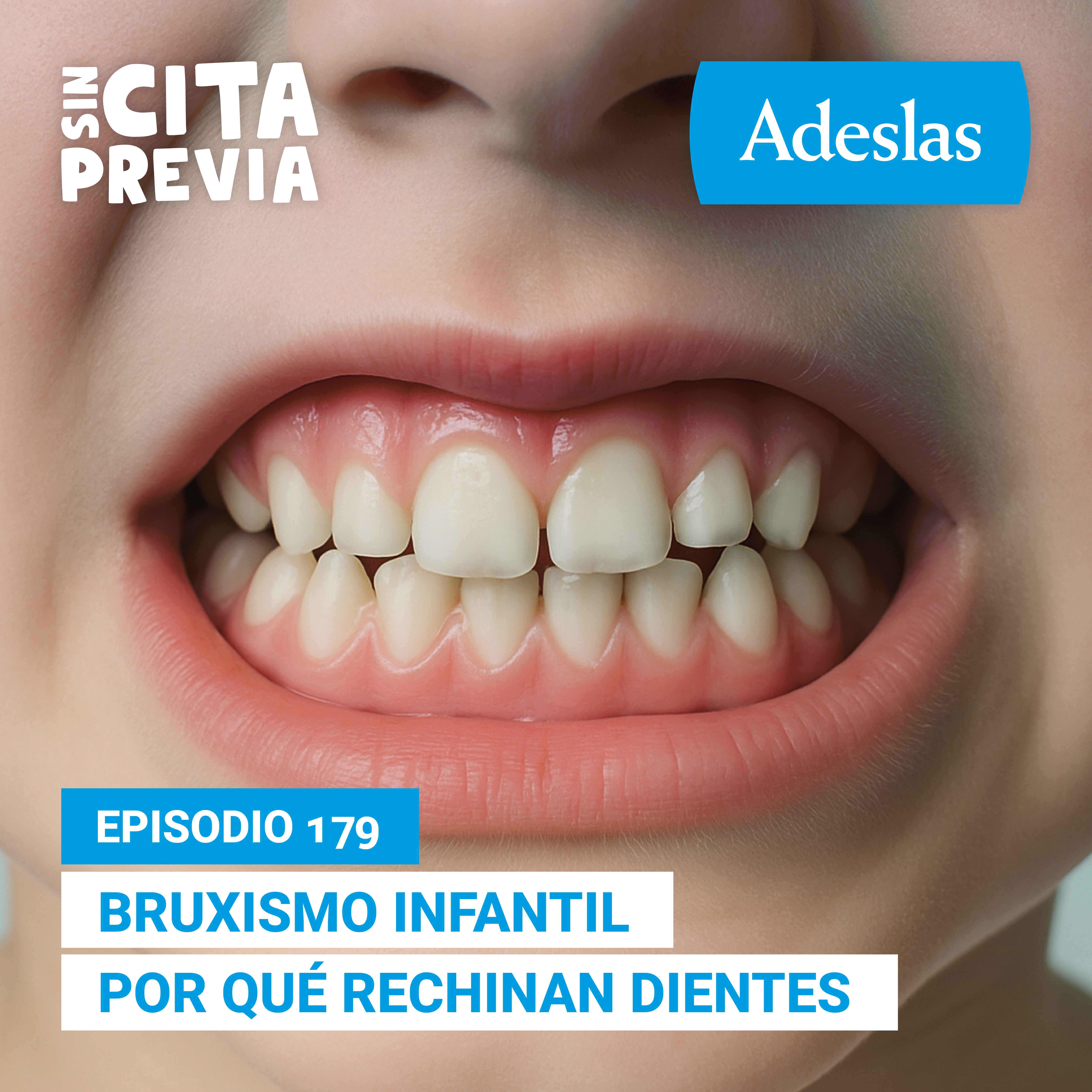 Bruxismo infantil por qué rechinan dientes