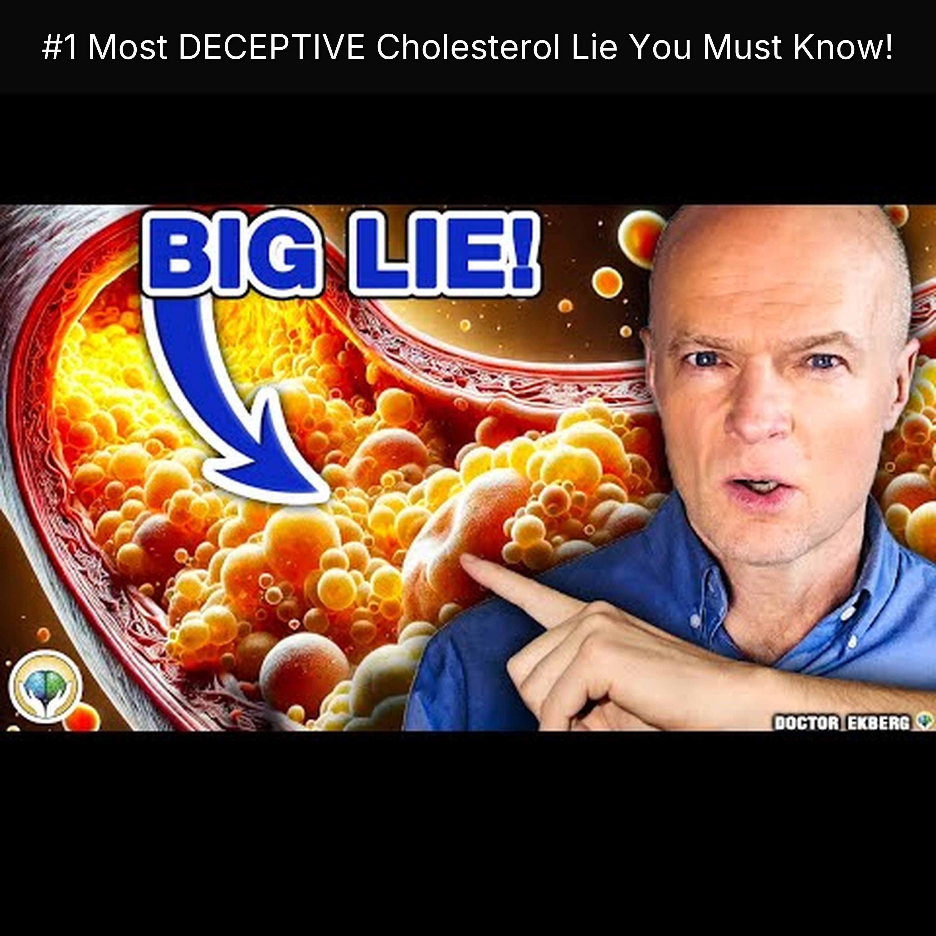 #1 Most DECEPTIVE Cholesterol Lie You Must Know! episode artwork