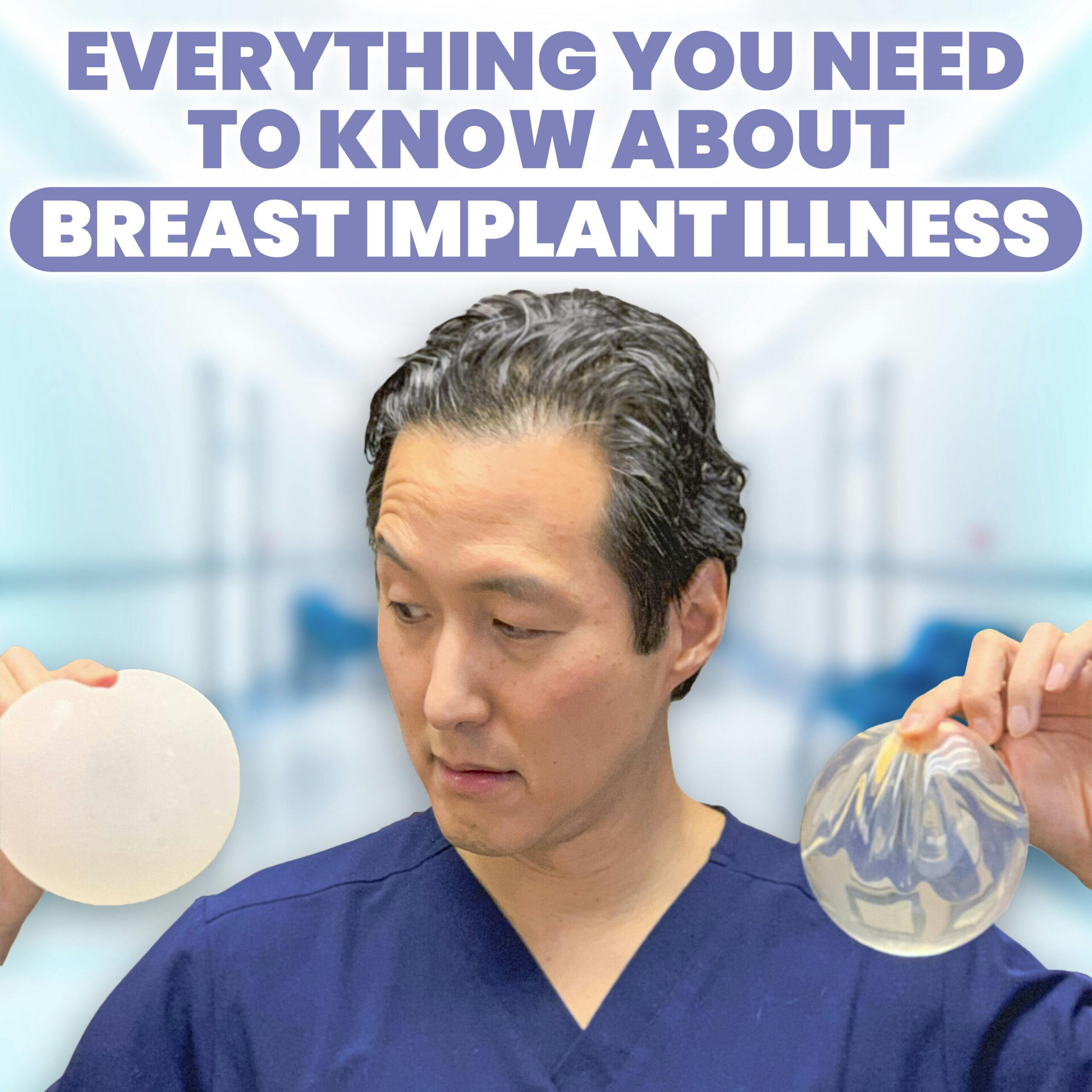 Breast Implant Illness (BII): Update and Everything You Need to Know