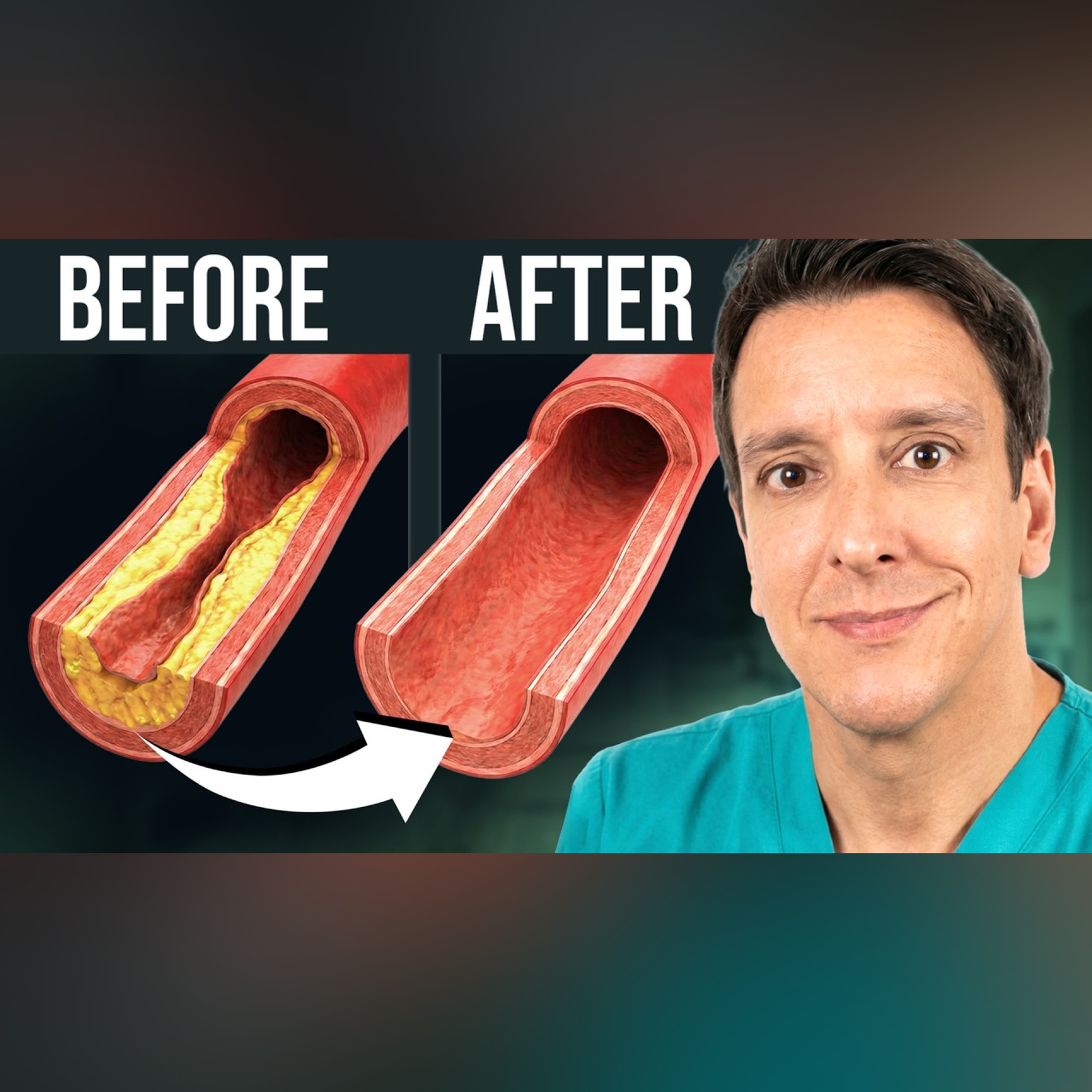 Top 10 Foods to Unclog Arteries (Ranked)