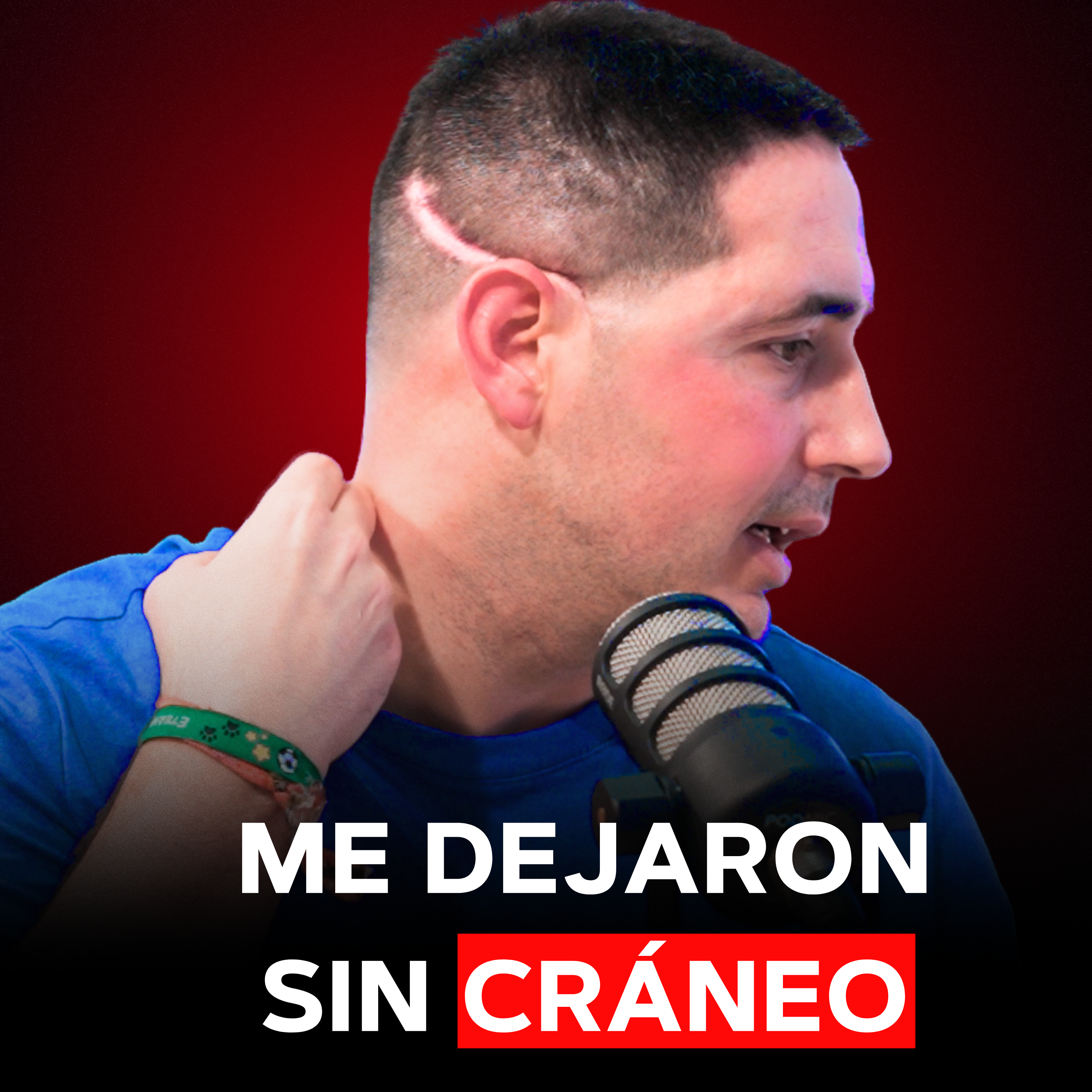 Sufrí un ICTUS y para SALVARME me Dejaron SIN CRÁNEO episode artwork