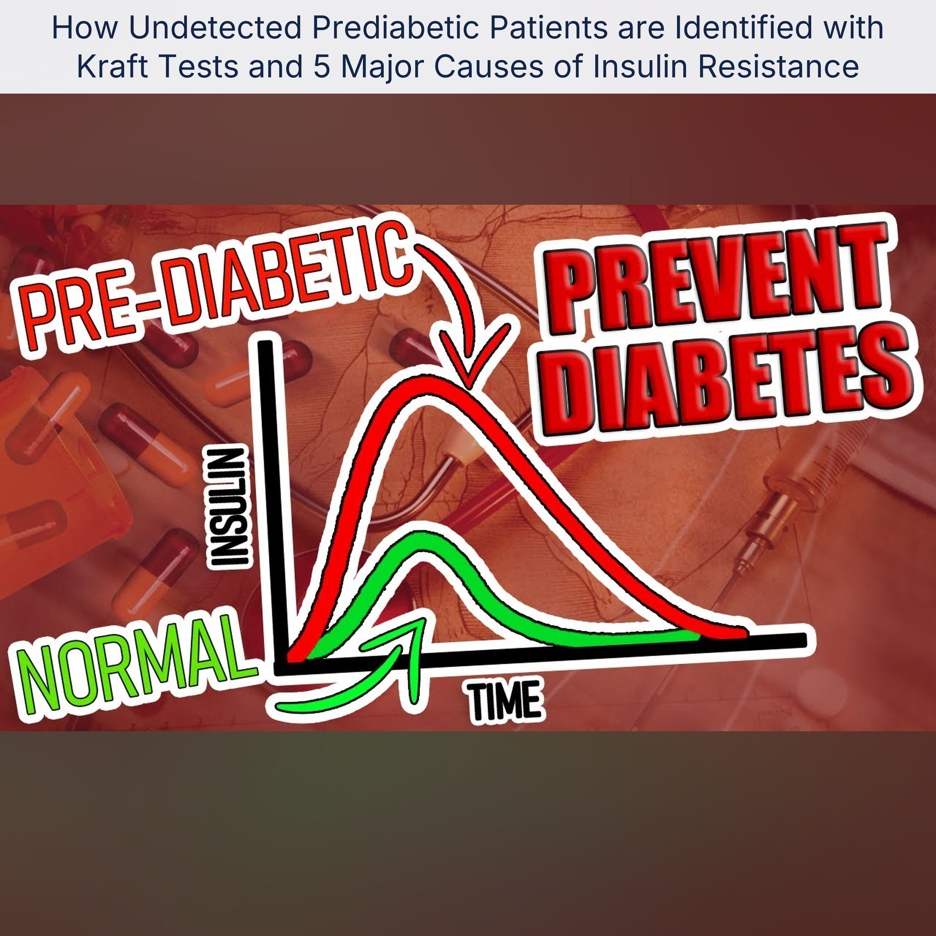 How Undetected Prediabetic Patients are Identified with Kraft Tests and 5 Major Causes of Insulin Resistance